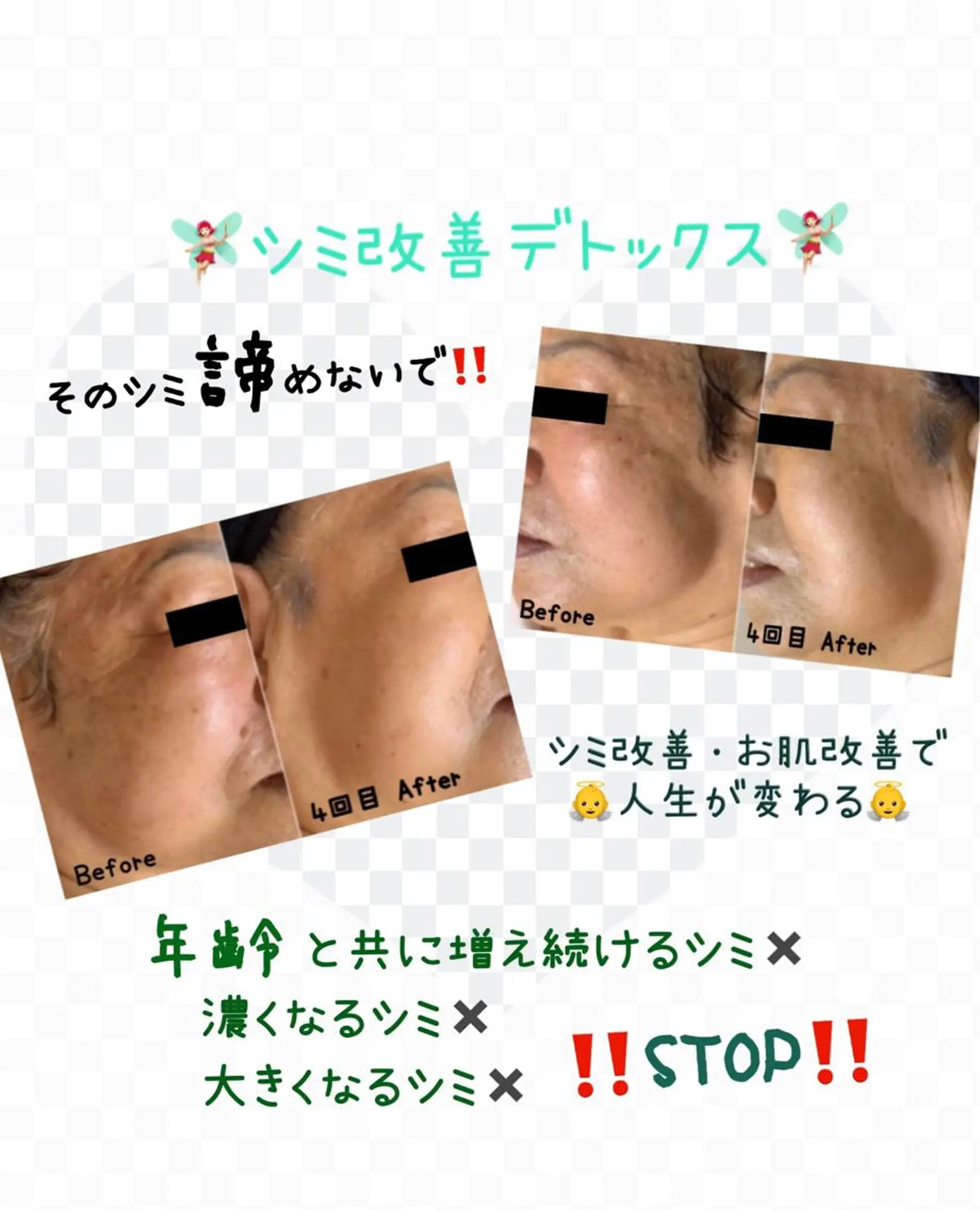 エステ ヴィーナス ビューティーのエステ・リラクイメージ