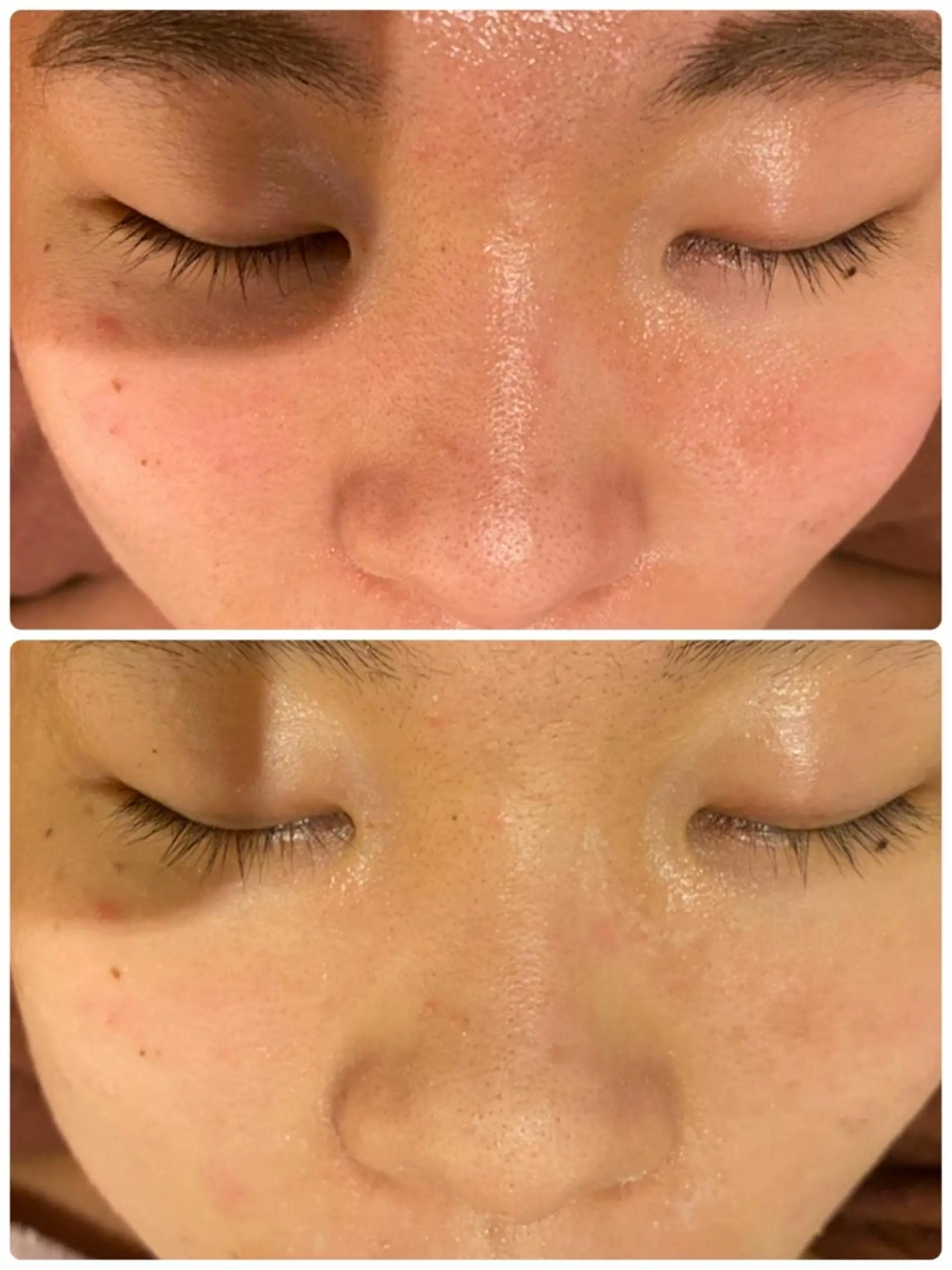 セミロング カラー パーマ ヘアアレンジ メンズ キッズ ネイル マツエク・マツパ アイブロウ 3か月で肌革命👼 ニキビ専門店💫のエステ・リラクイメージ