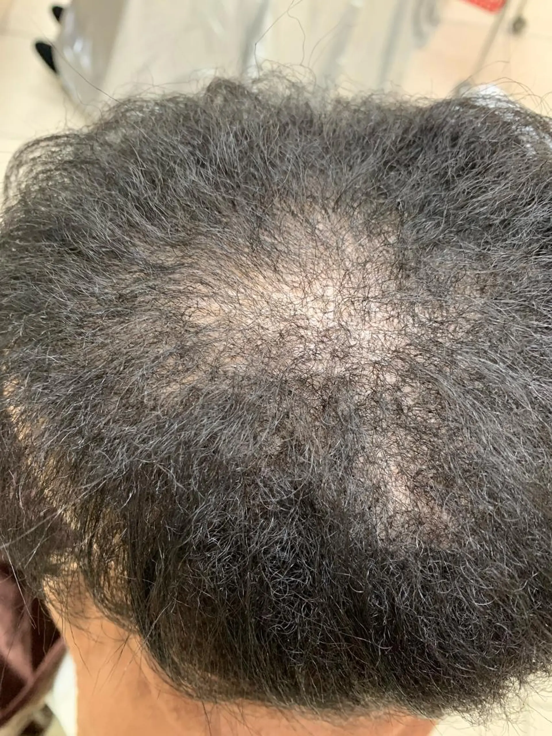 ミディアム 縮毛矯正 美容室HAAS所属・竹内 英明のヘアスタイル