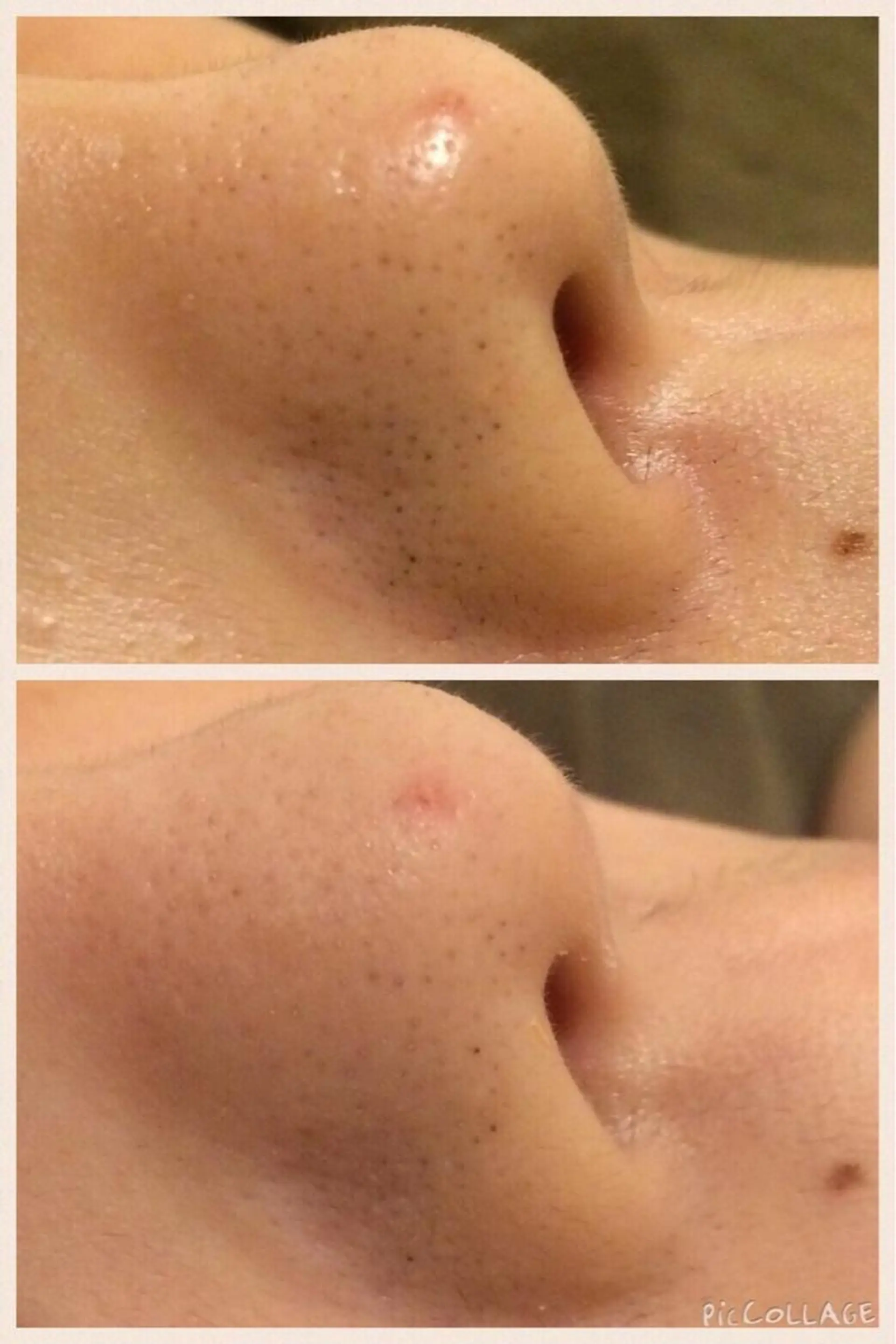 メンズ 金の糸脱毛 産毛ケア専門のエステ・リラクイメージ