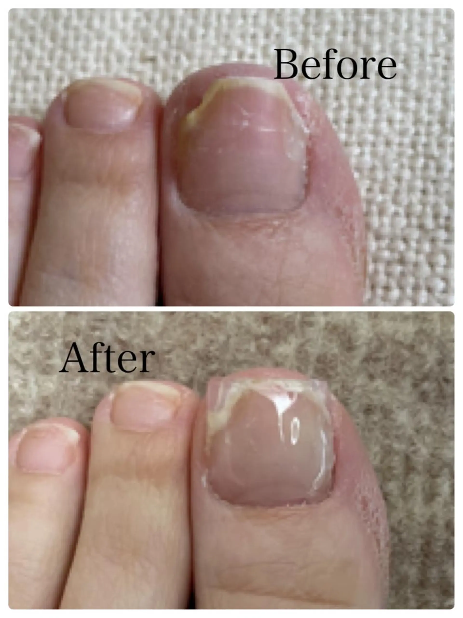 ENSIA エンシアのネイルデザイン