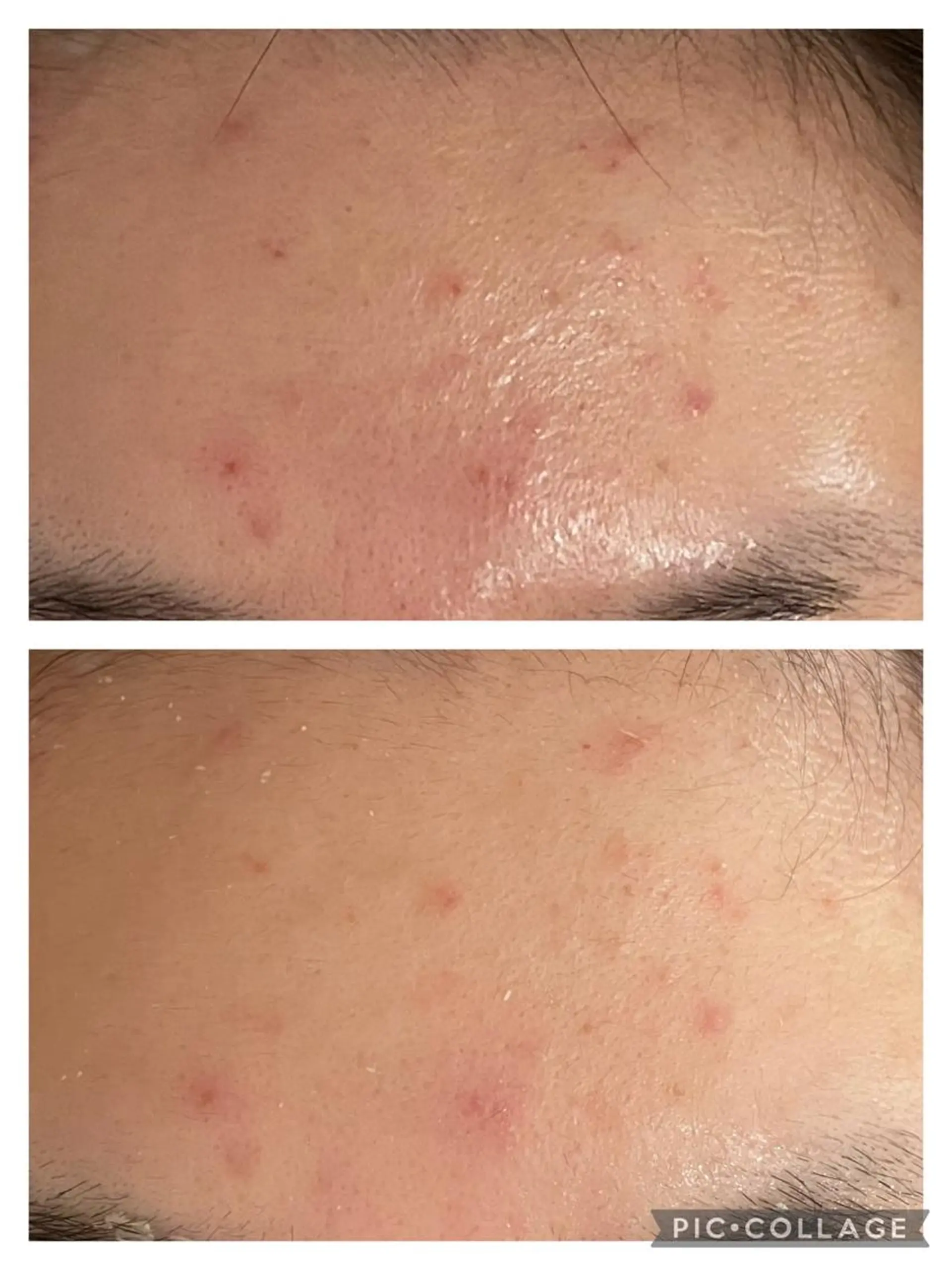 セミロング カラー パーマ ヘアアレンジ メンズ キッズ ネイル マツエク・マツパ アイブロウ 3か月で肌革命👼 ニキビ専門店💫のエステ・リラクイメージ