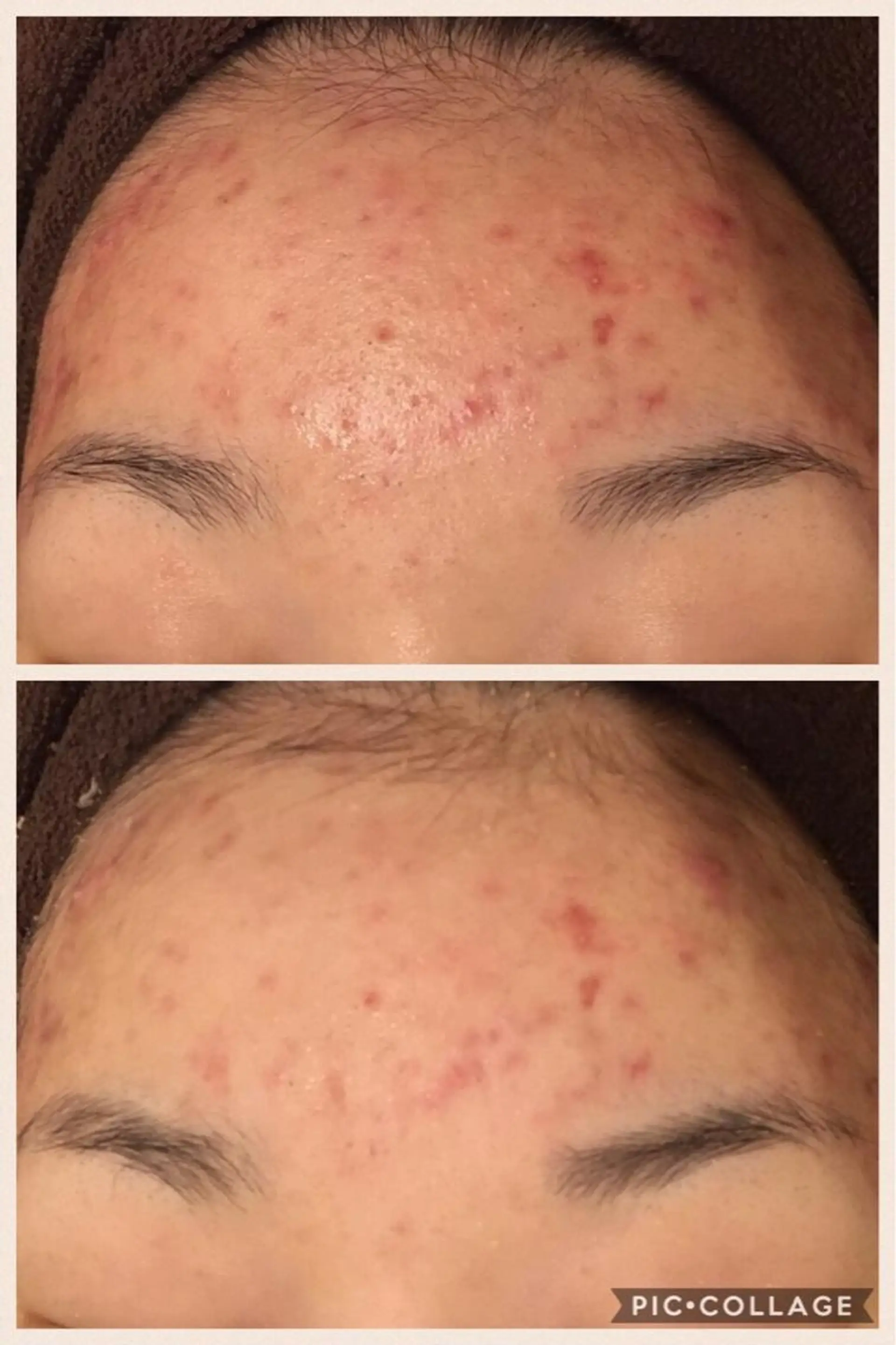 ニキビ・肌質改善専門 ♡人生が変わるサロンのエステ・リラクイメージ