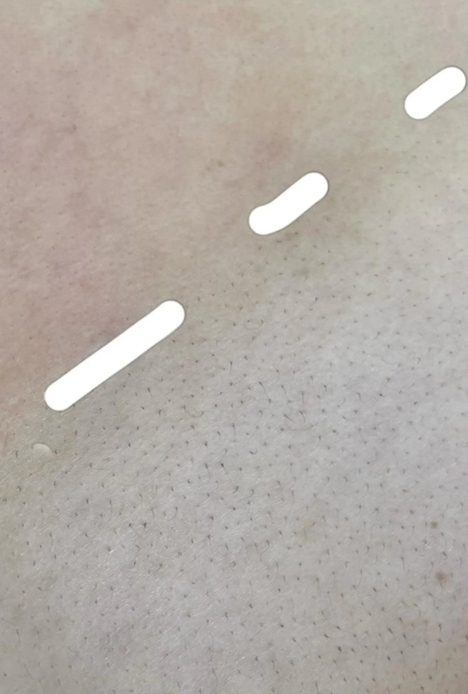 KIRAN 山﨑のエステ・リラクイメージ