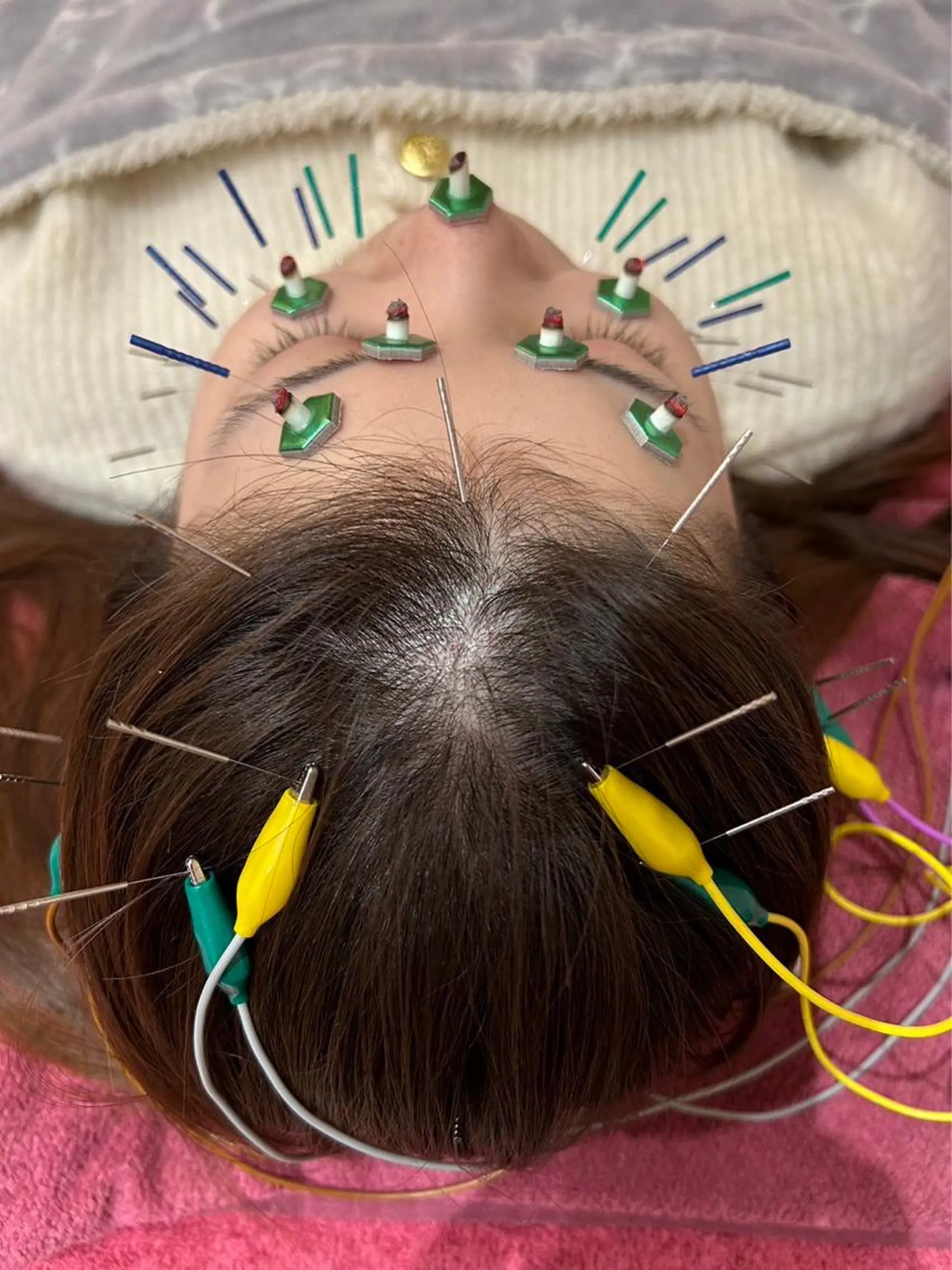 エステ リラク 美容鍼灸女性専用 りんご鍼灸治療院のその他イメージ