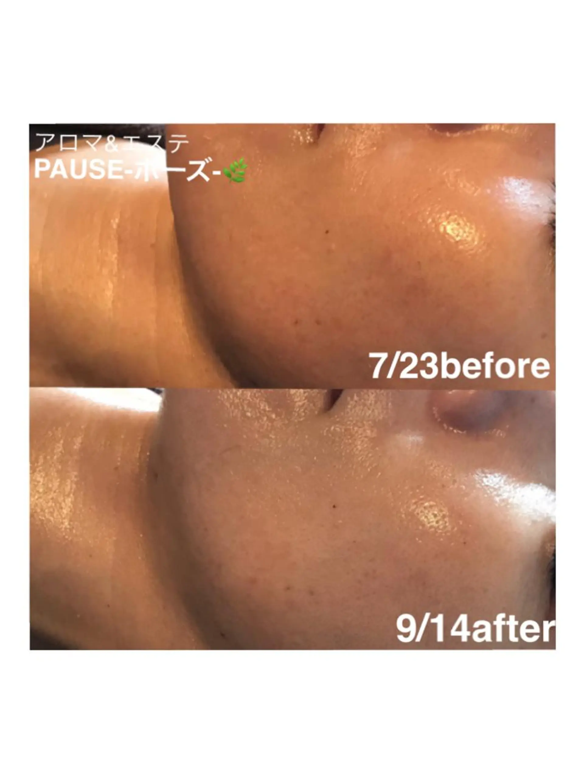 エステ 浜野 恵美のエステ・リラクイメージ