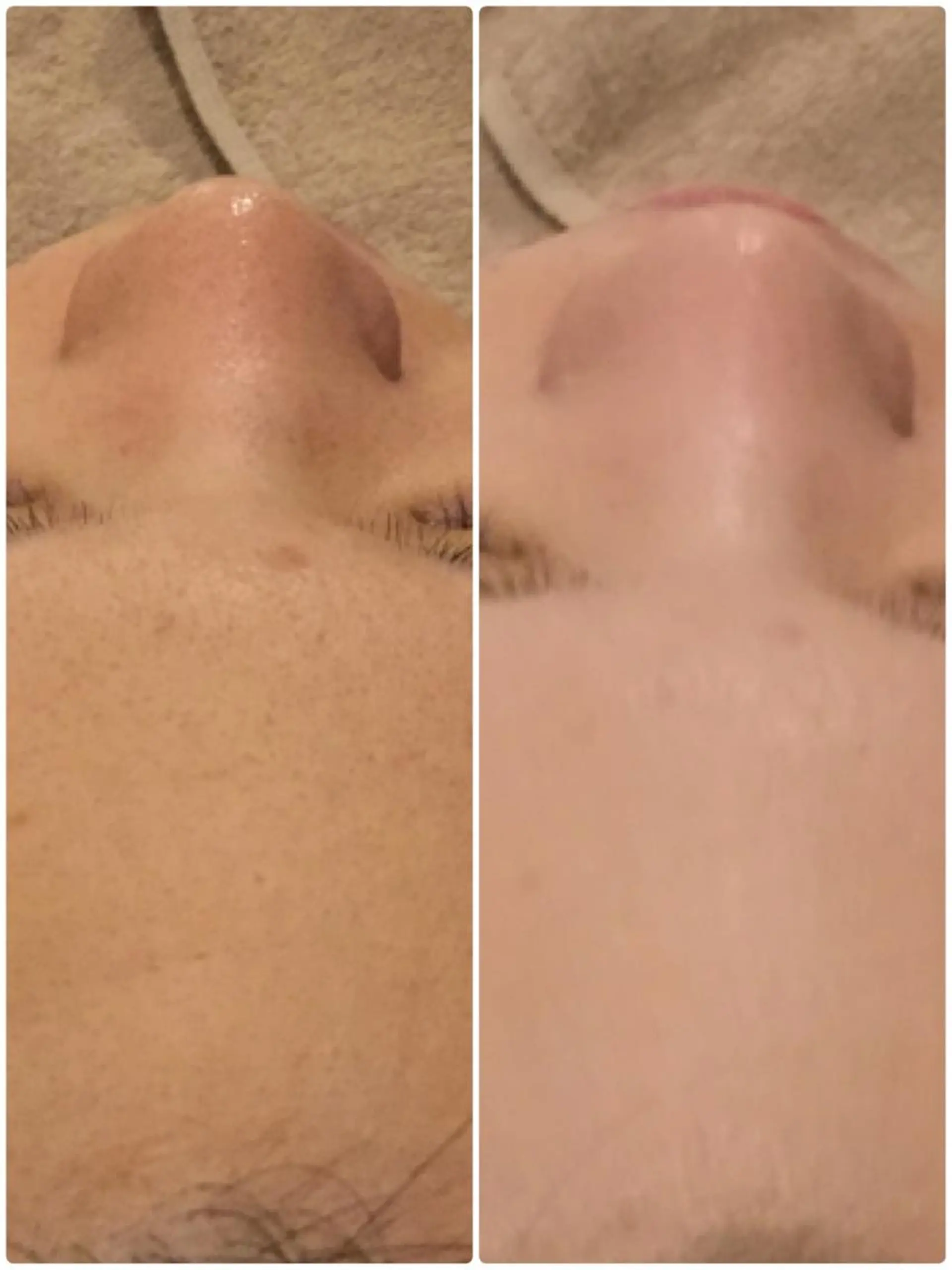 エステ 【リベルハーブピーリング認定店】敏感肌・美白脱毛専門店Dione立川店所属・Dione 立川店のエステ・リラクイメージ