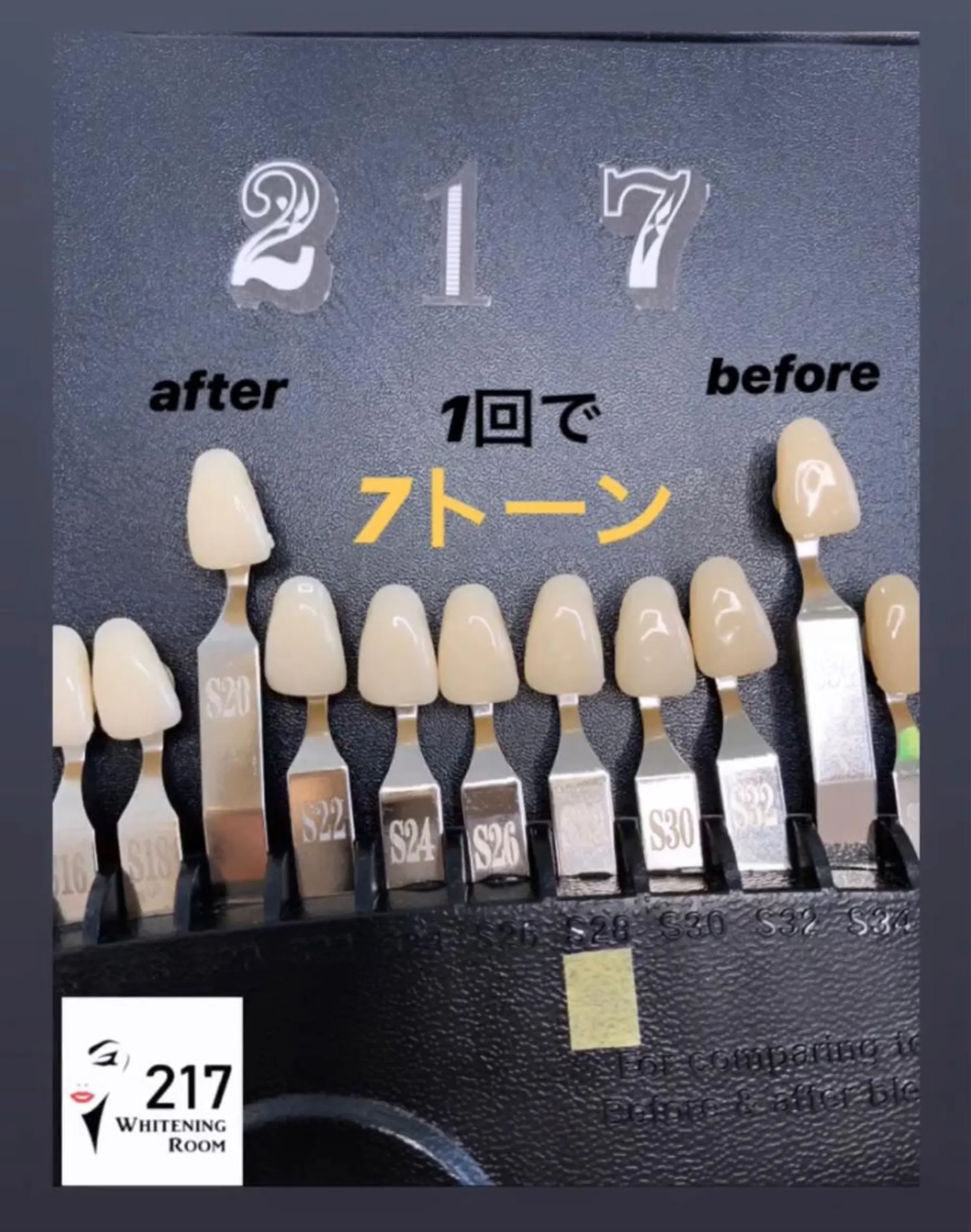 メンズ キッズ その他 217whitening  room所属・217 ホワイトニングルームのエステ・リラクイメージ
