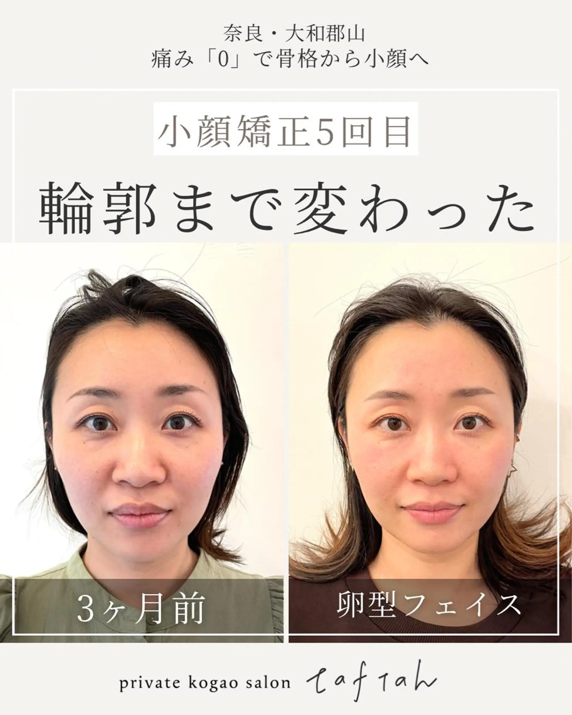 小顔   目元専門 taftahタフタのマツエク・マツパデザイン