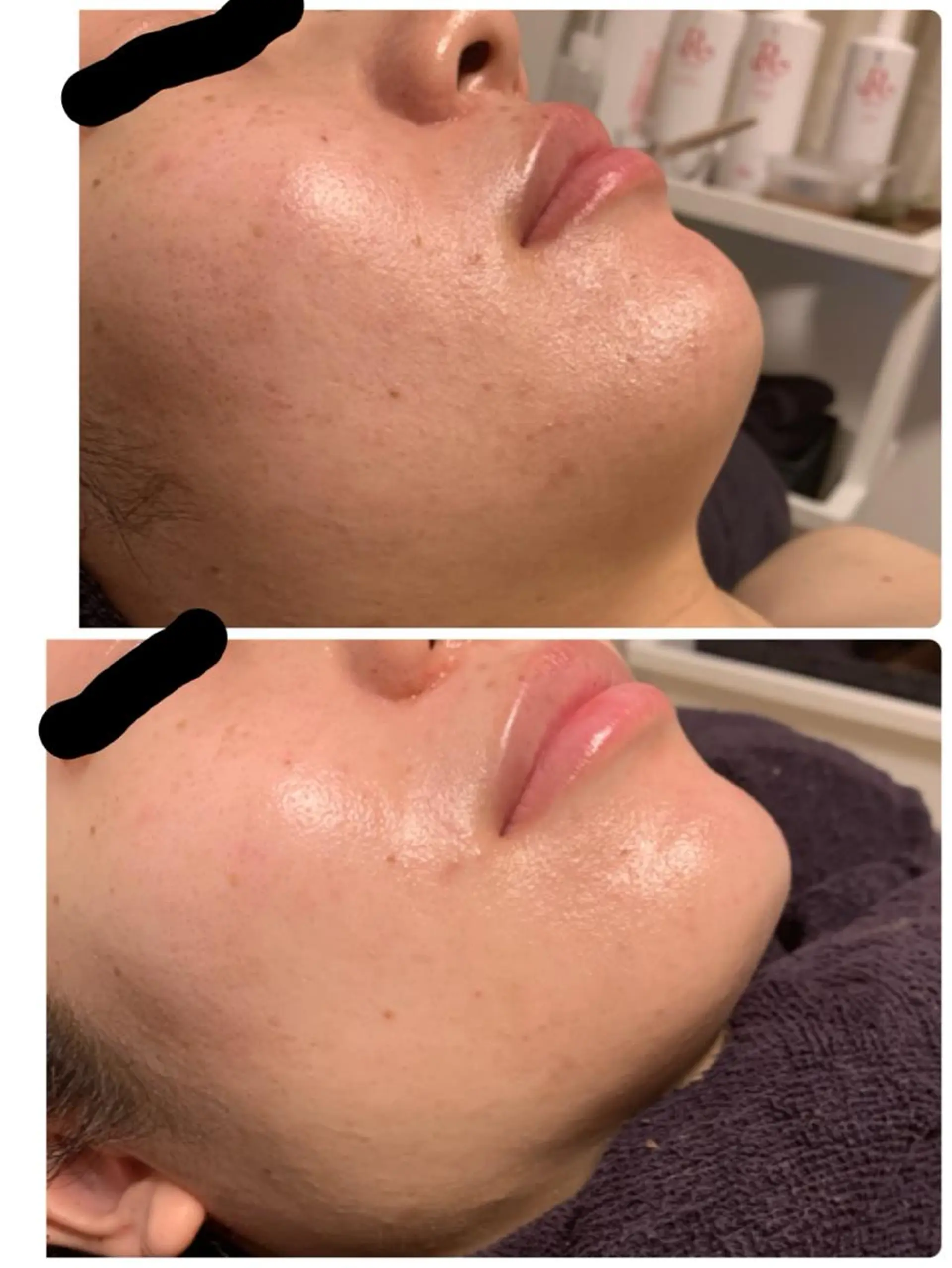 エステ 柳澤 歩のその他イメージ