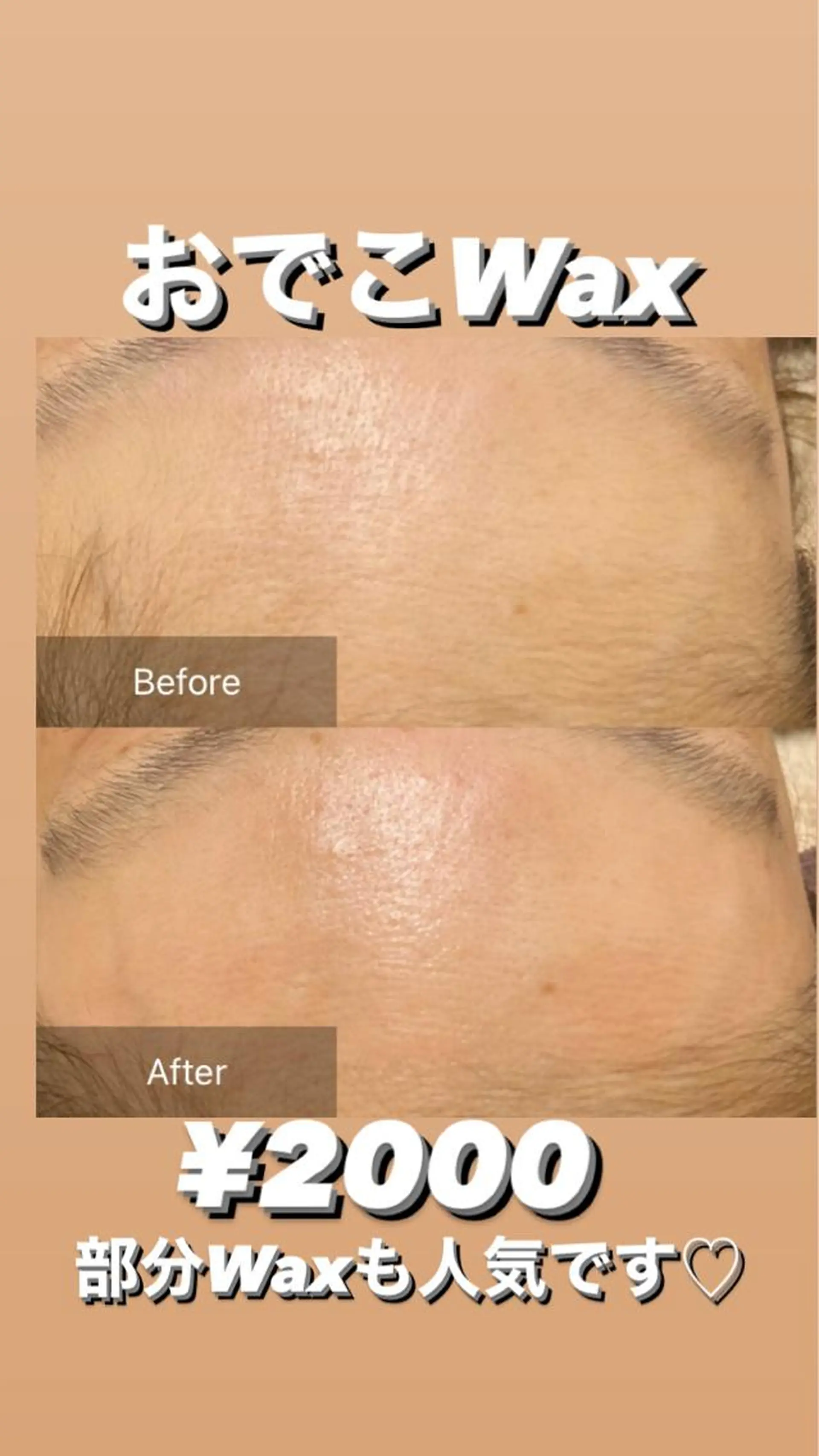 脱毛 産毛専門店 Bittoのエステ・リラクイメージ