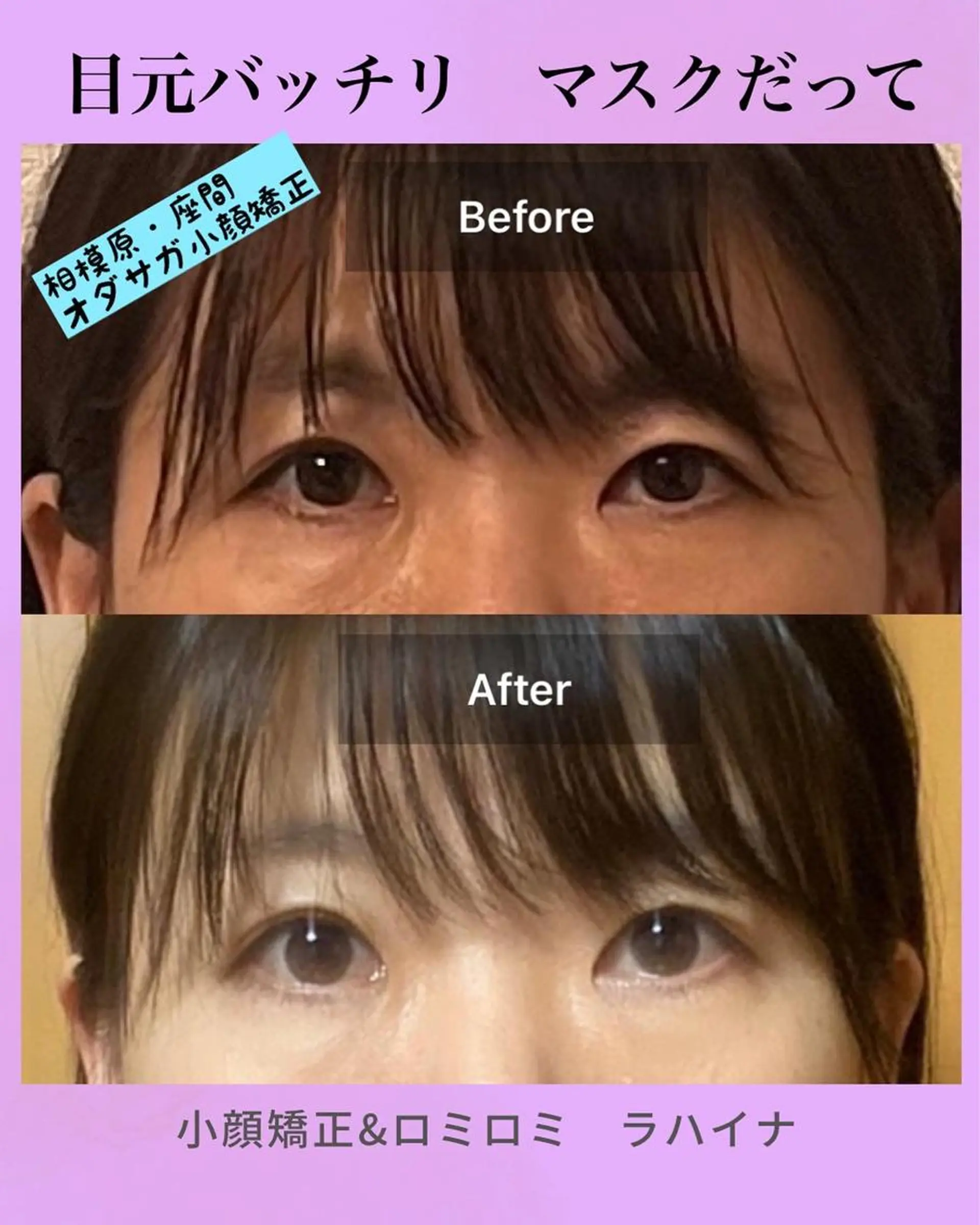 小顔矯正＆ロミロミ ラハイナ所属・小顔矯正 ラハイナのエステ・リラクイメージ