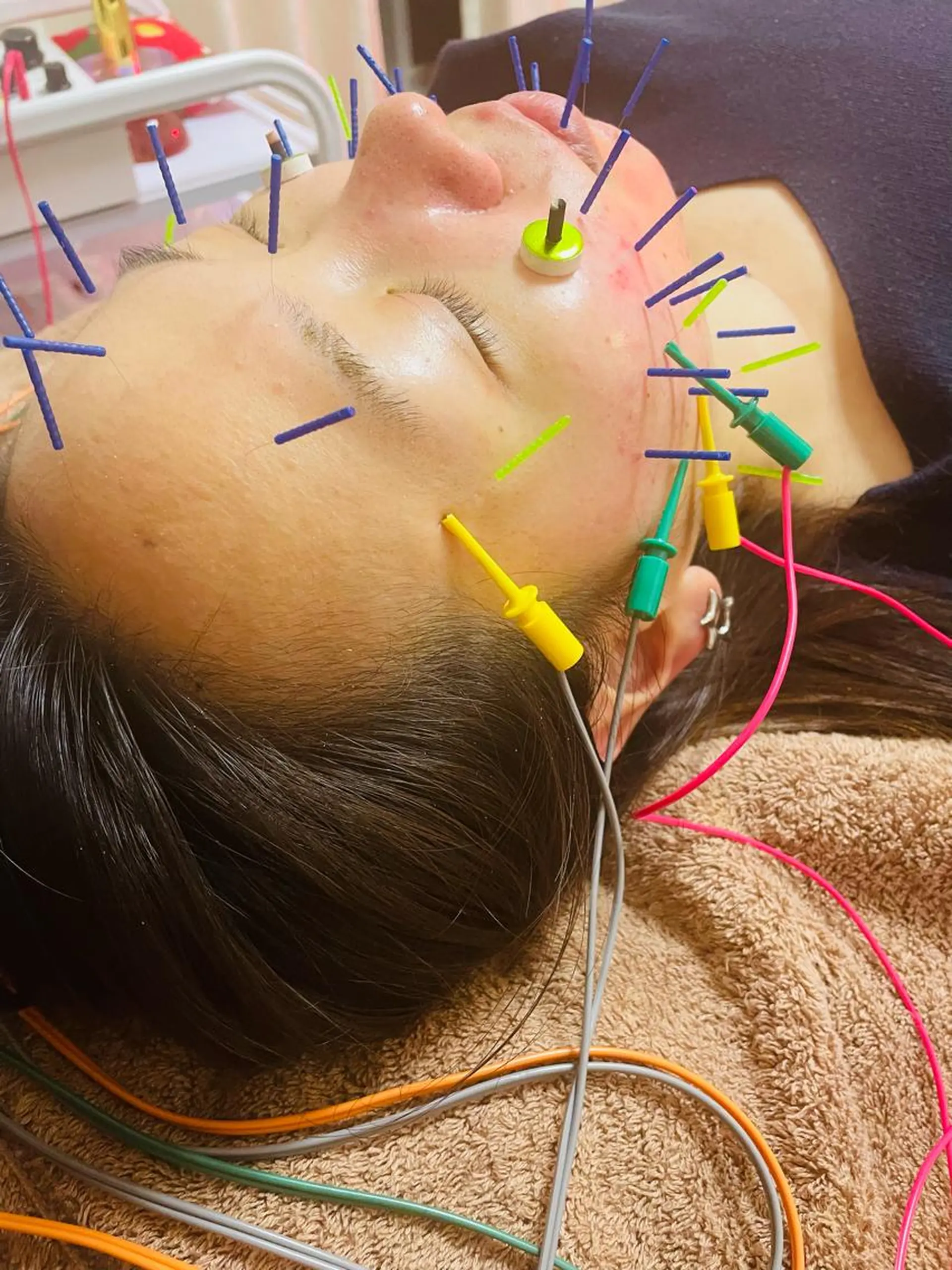 美容鍼灸サロン mahoroba院長のエステ・リラクイメージ