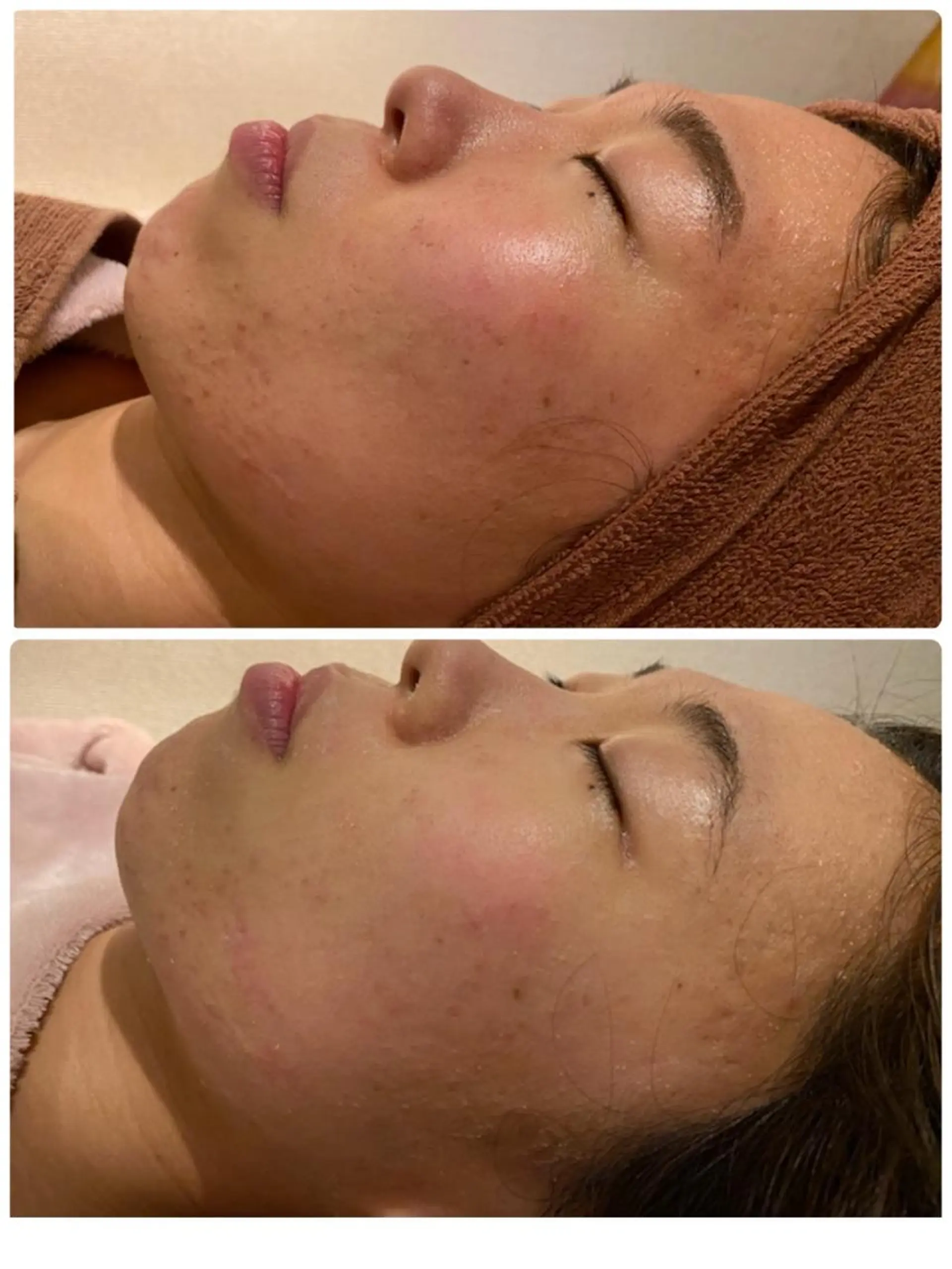 セミロング カラー パーマ ヘアアレンジ メンズ キッズ ネイル マツエク・マツパ 3か月で肌革命👼 ニキビ専門店💫のエステ・リラクイメージ