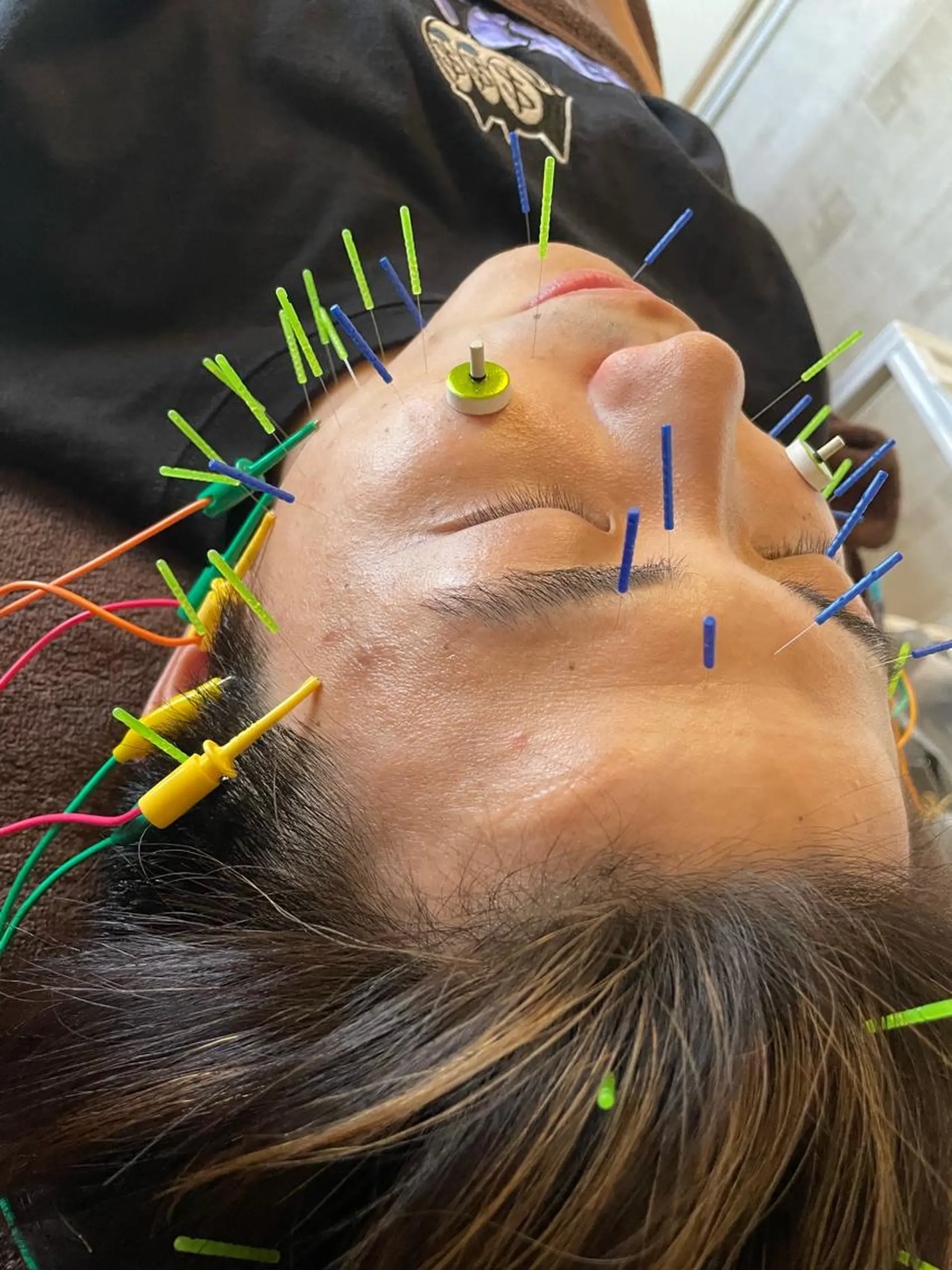 美容鍼灸サロン mahoroba院長のエステ・リラクイメージ