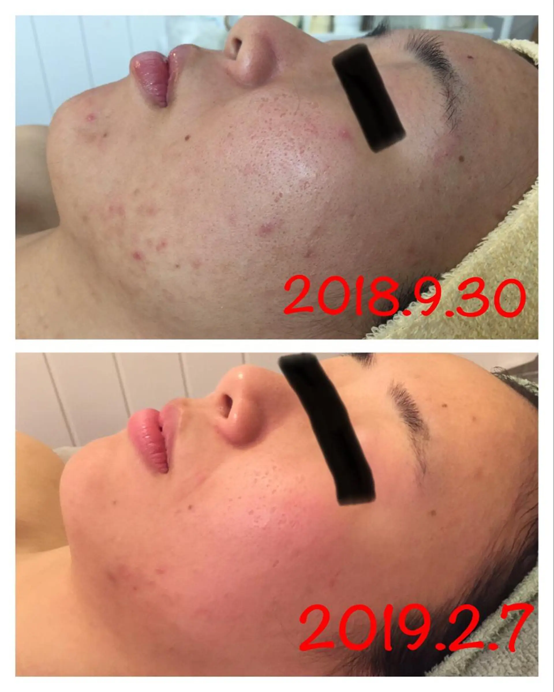 毛穴ツヤ肌専門    Lipulaのエステ・リラクイメージ