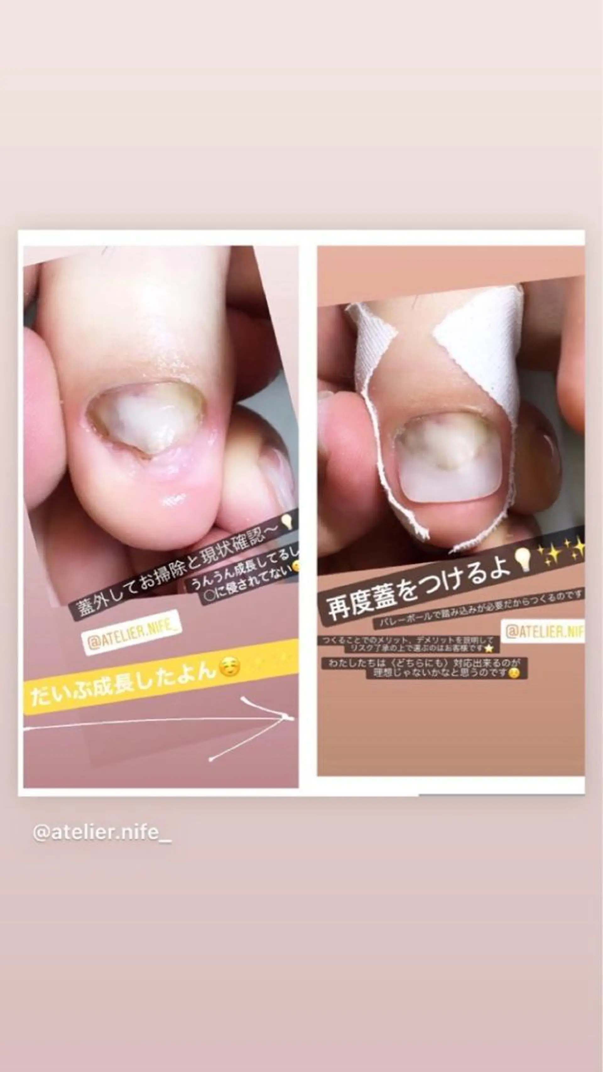 ネイル フットネイル atelier nife.のネイルデザイン