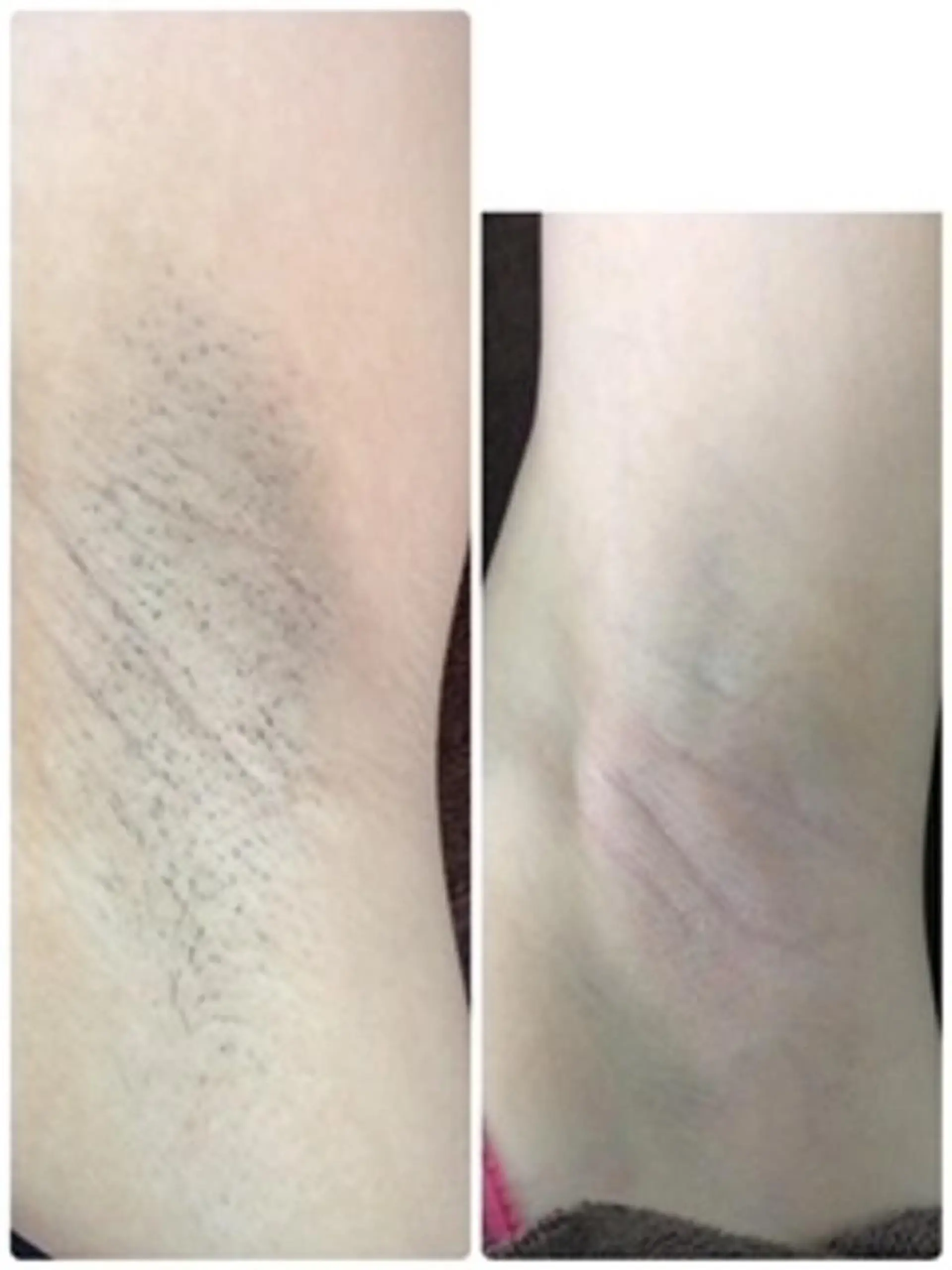 脱毛 Lien オーナー 山口智嘉のエステ・リラクイメージ