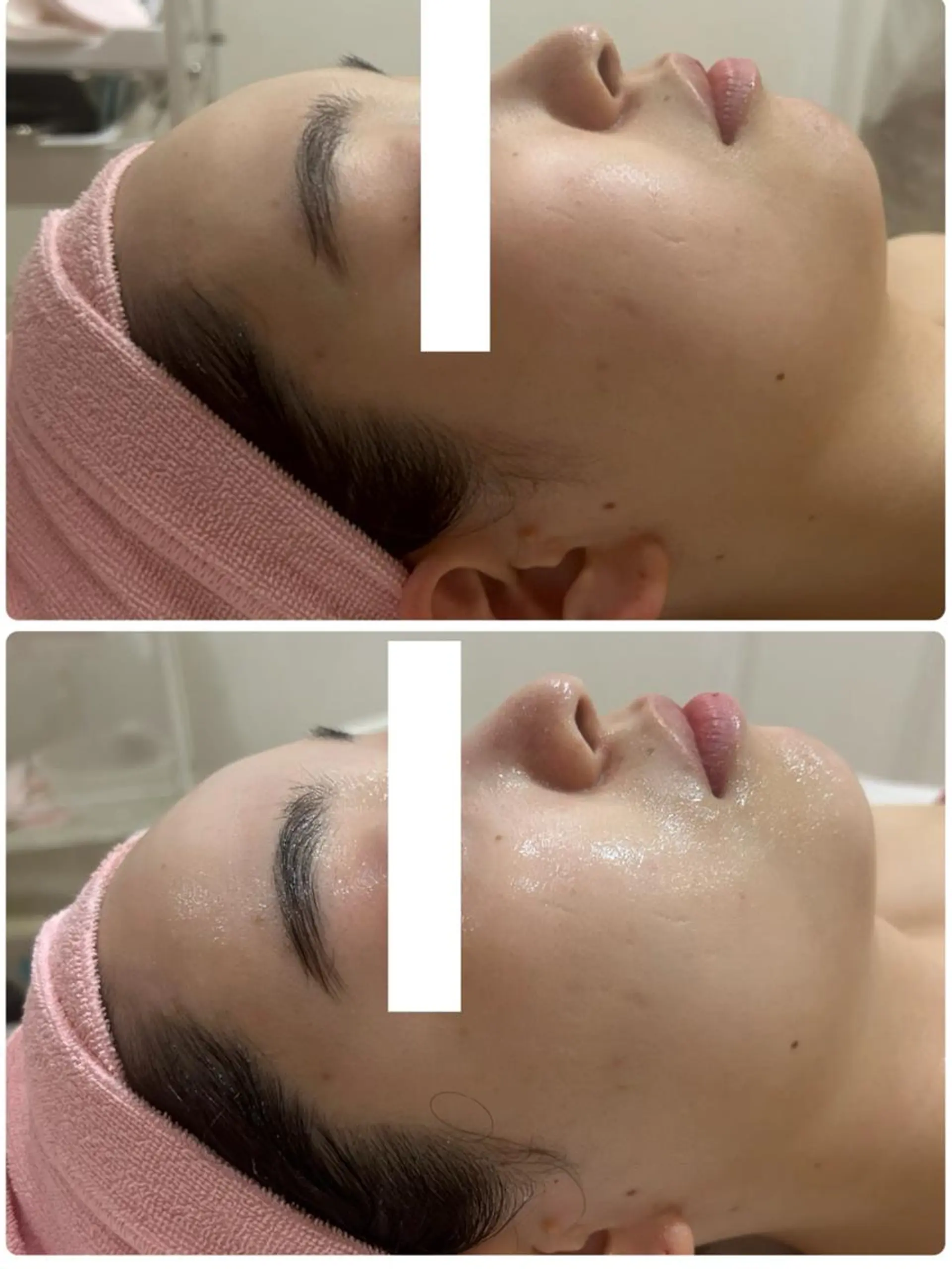 エステ ♡RAYVIS♡ 名古屋店　神田のエステ・リラクイメージ