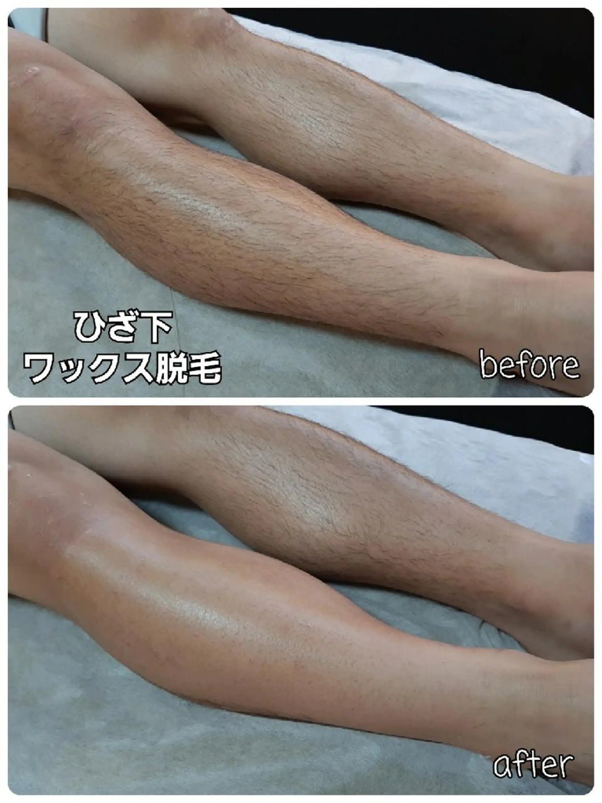 メンズ メンズ・脱毛サロン DEARS所属・山村幸久　メンズ脱毛 ディアーズのエステ・リラクイメージ