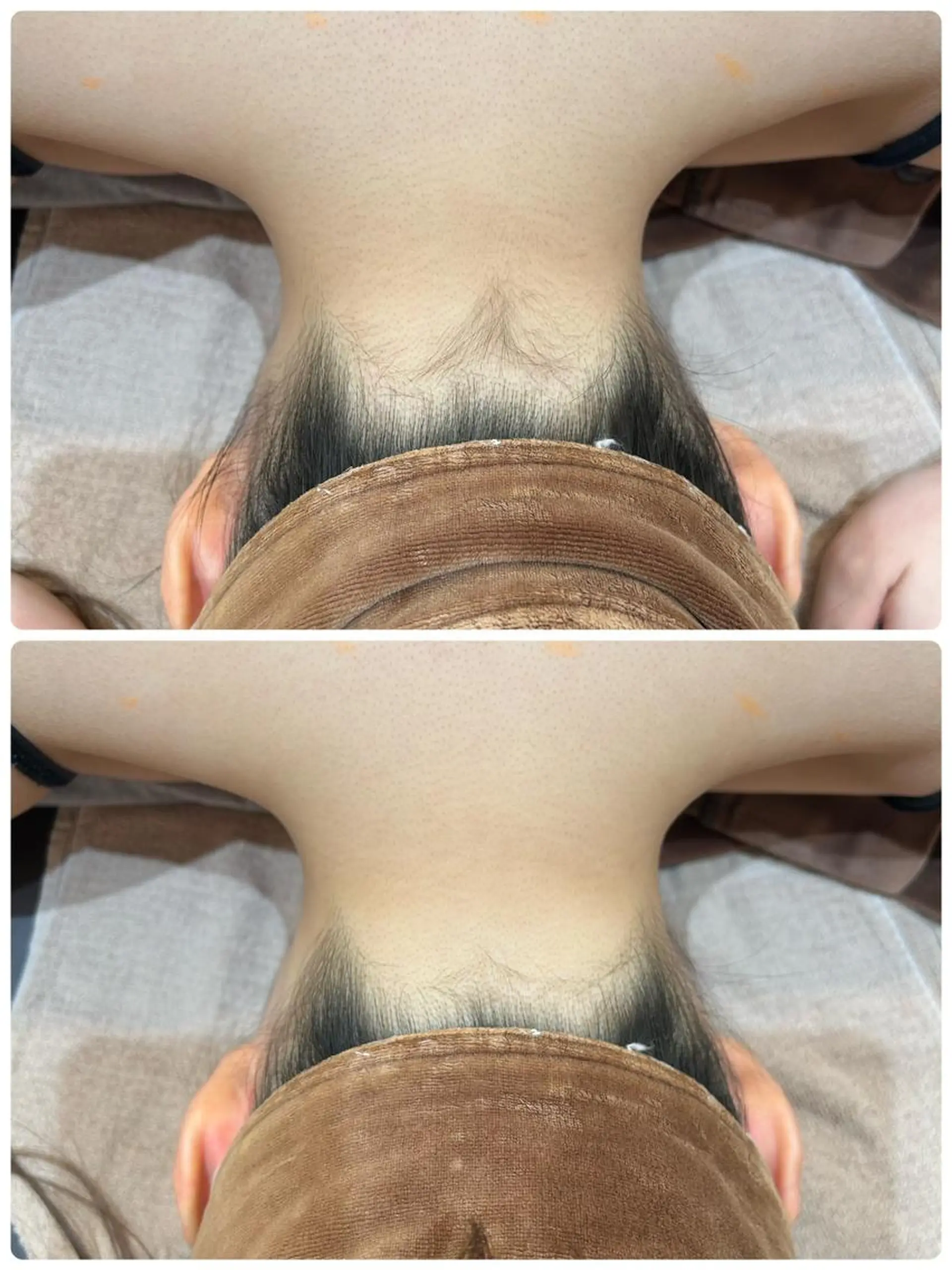 脱毛 👑Linola👑 レイビス　纐纈のエステ・リラクイメージ