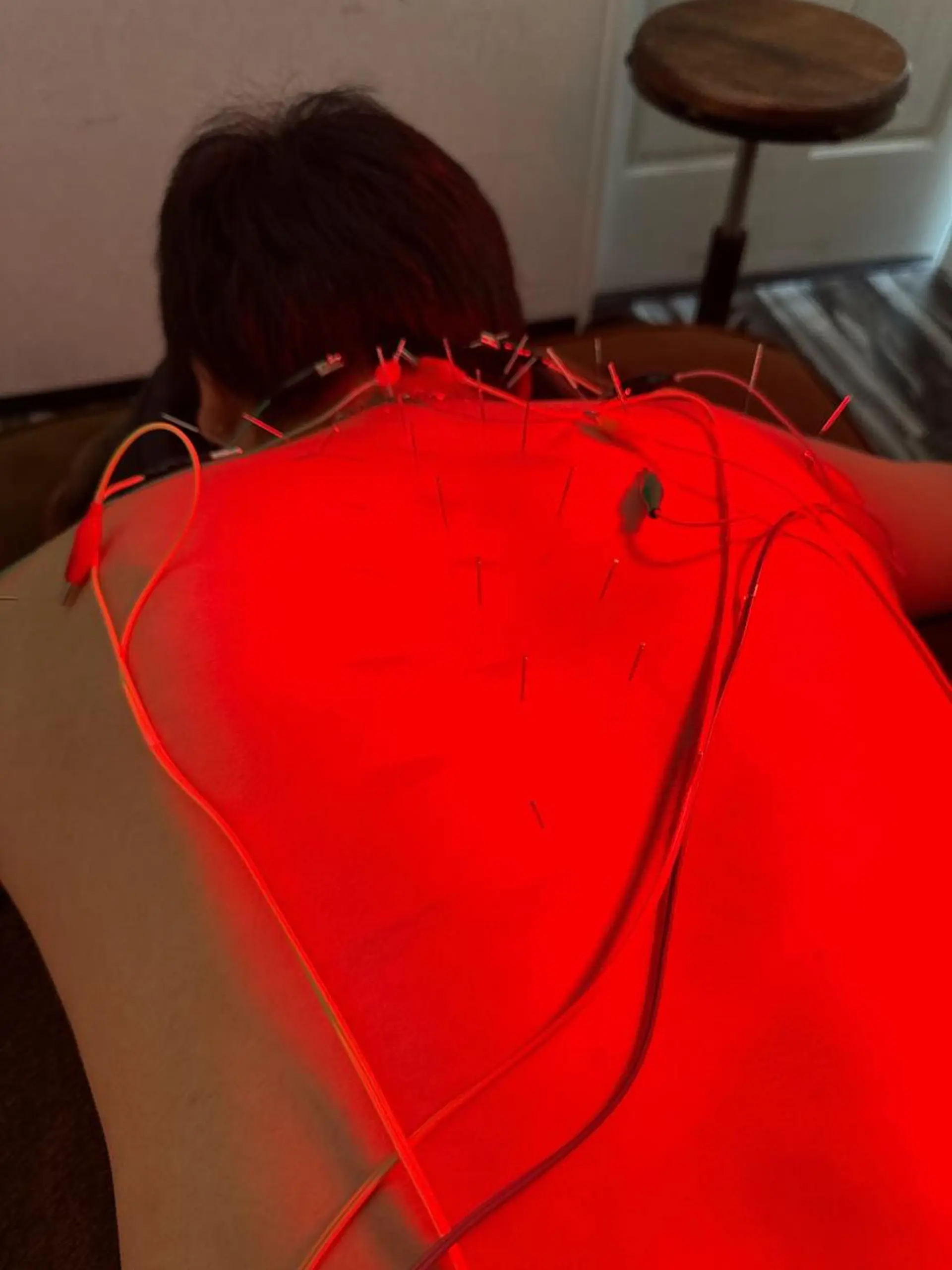 その他 小顔矯/美容鍼/鍼灸 BeauJuのその他イメージ