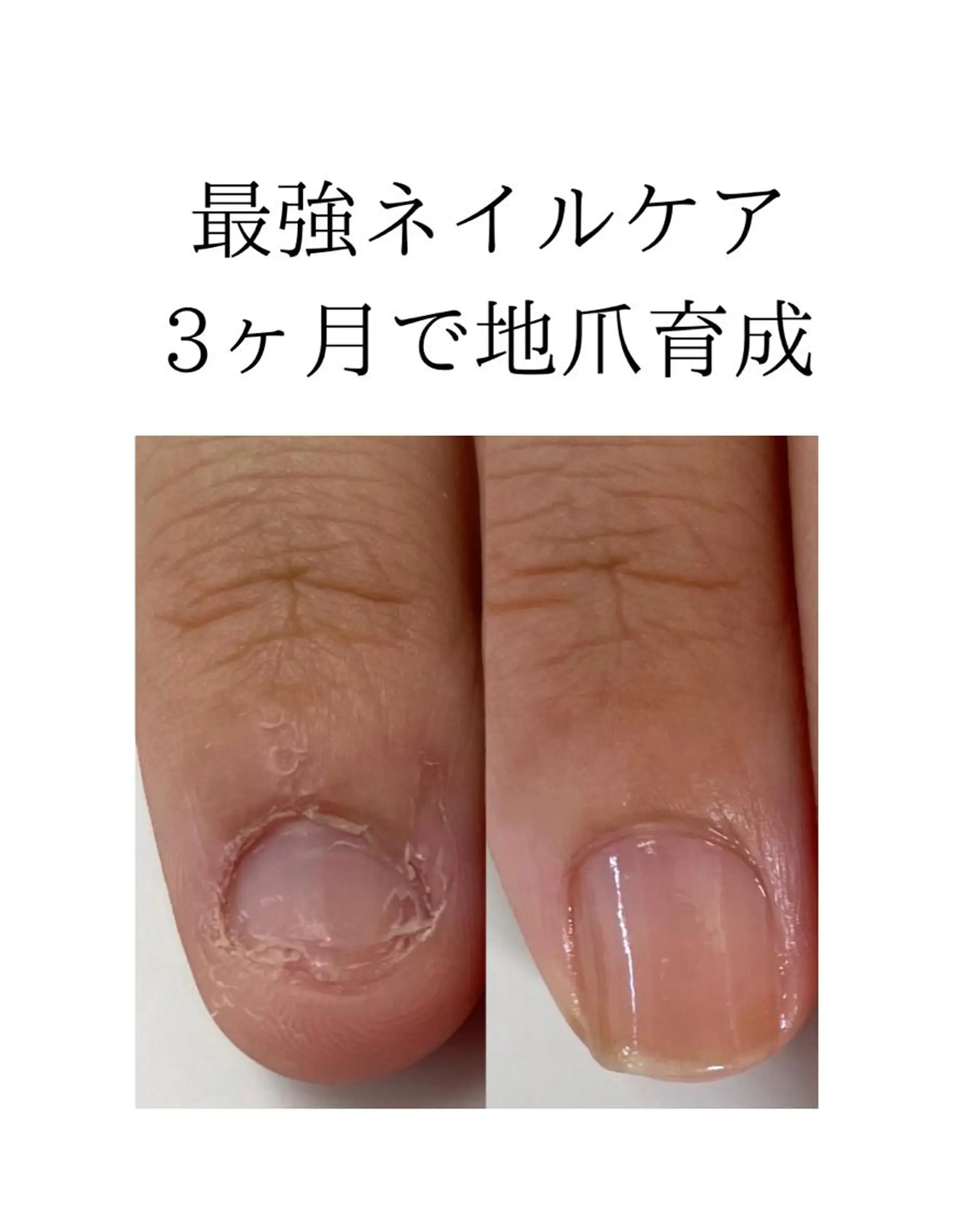 ネイル TiALASH ＊Kozue＊のネイルデザイン