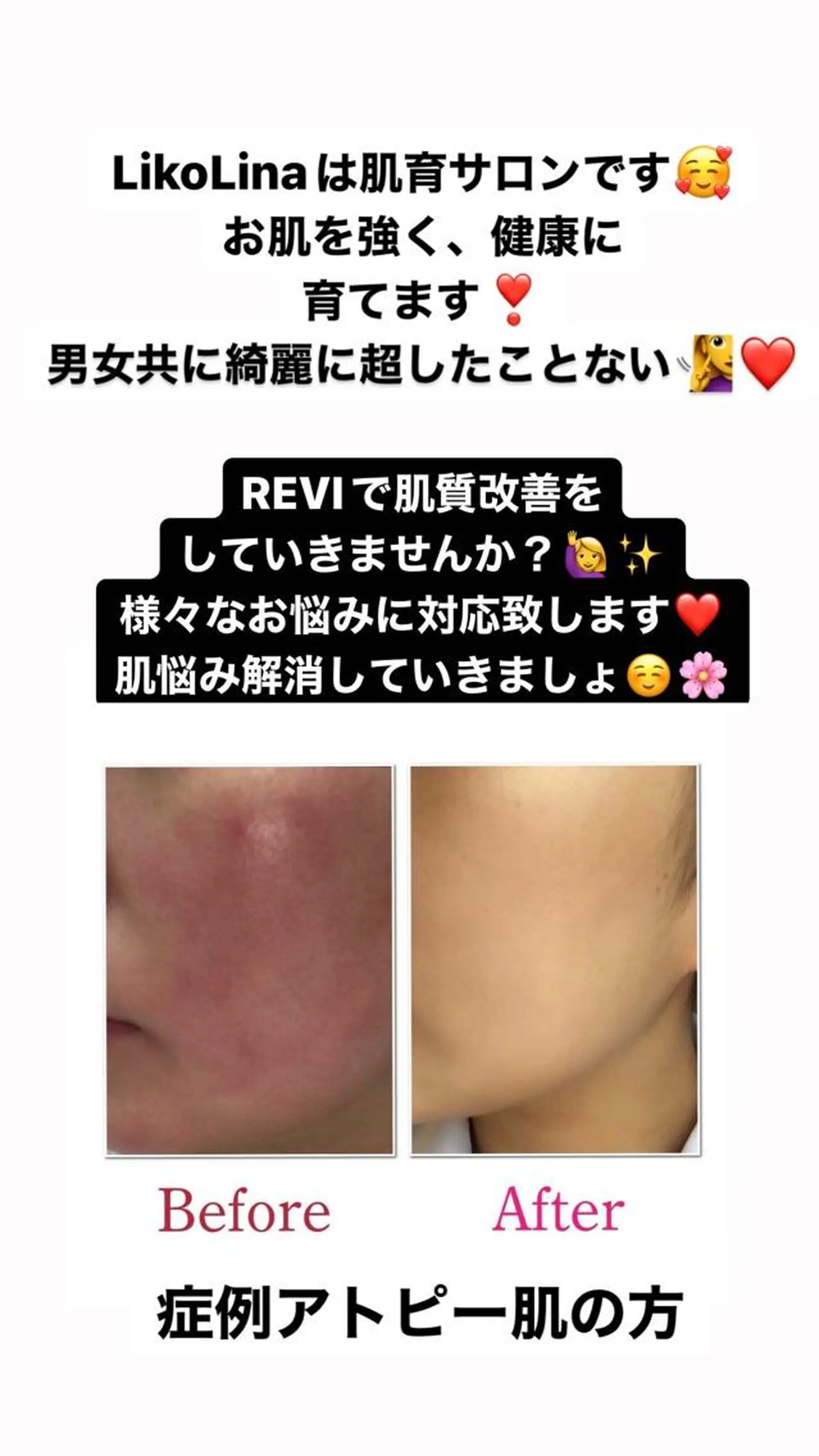 肌育脱毛サロン LikoLinaのその他イメージ