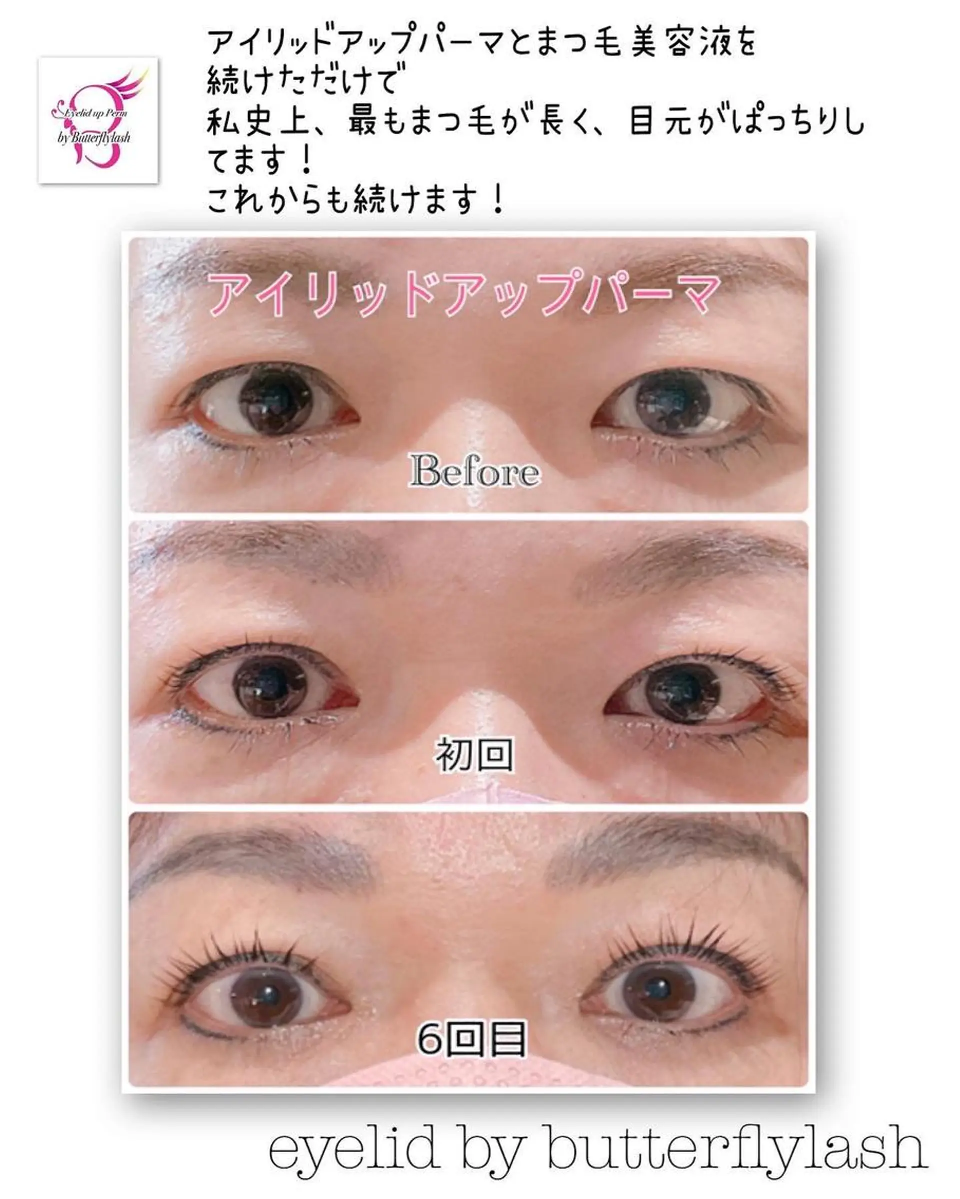 マツエク・マツパ アイリッドアップパーマ マツエク&まつ毛カールサロン　バタフライ・ラッシュ所属・下がりまつ毛たるみ 専門サロン妙蓮寺駅のマツエク・マツパデザイン