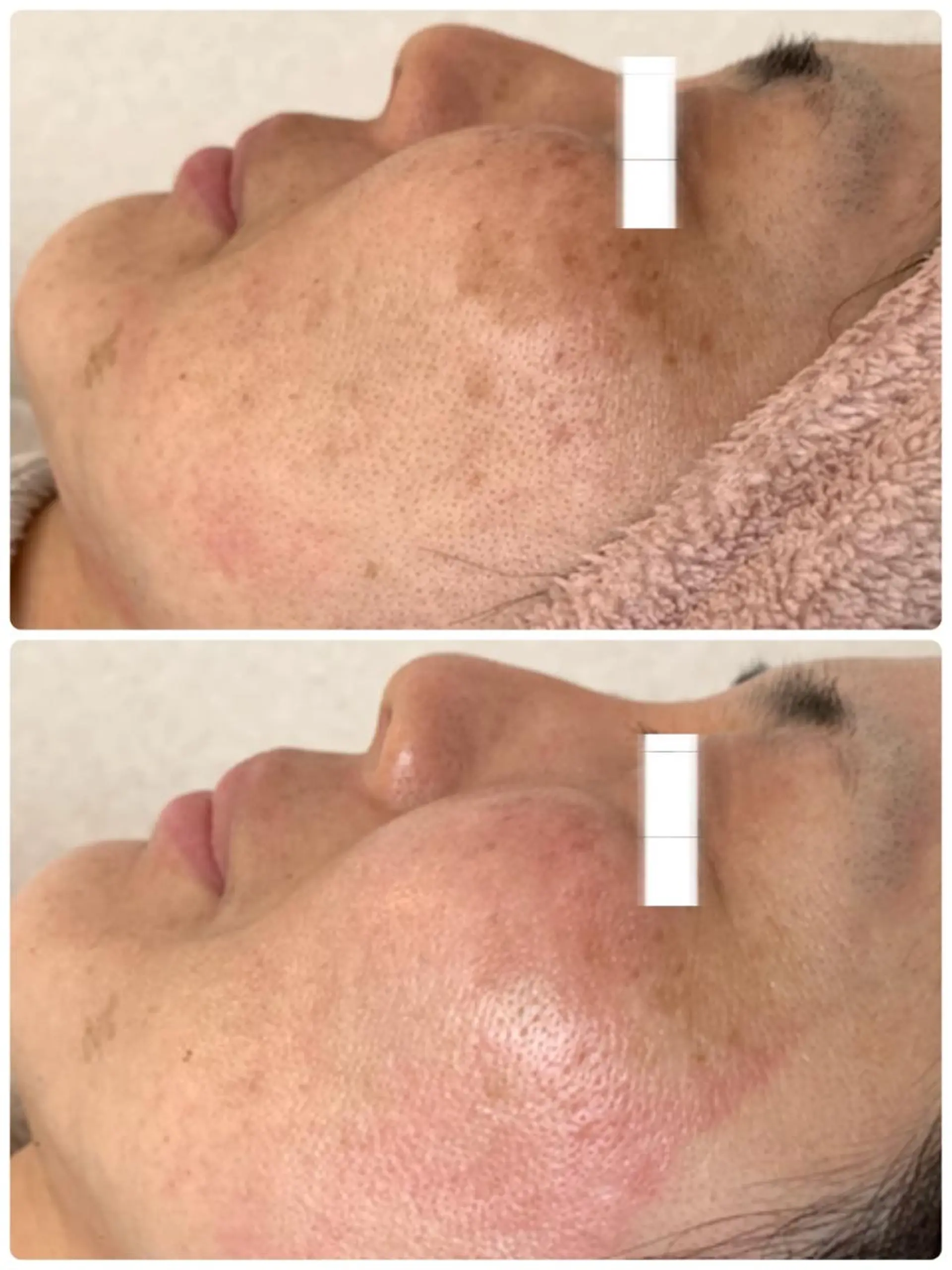 エステ 堀井 舞琳のエステ・リラクイメージ