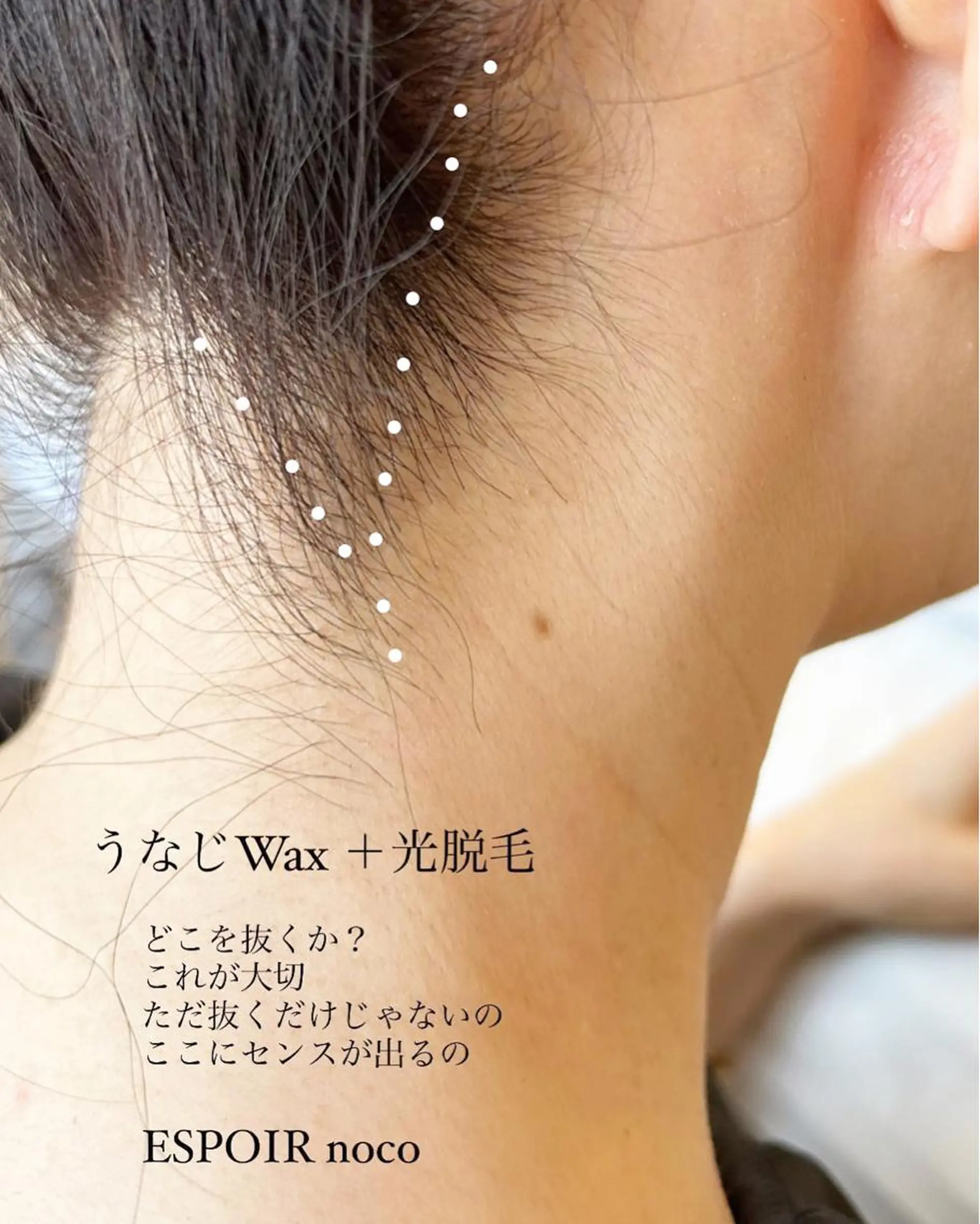 ワックス脱毛🌈 ESPOIRnocoのエステ・リラクイメージ