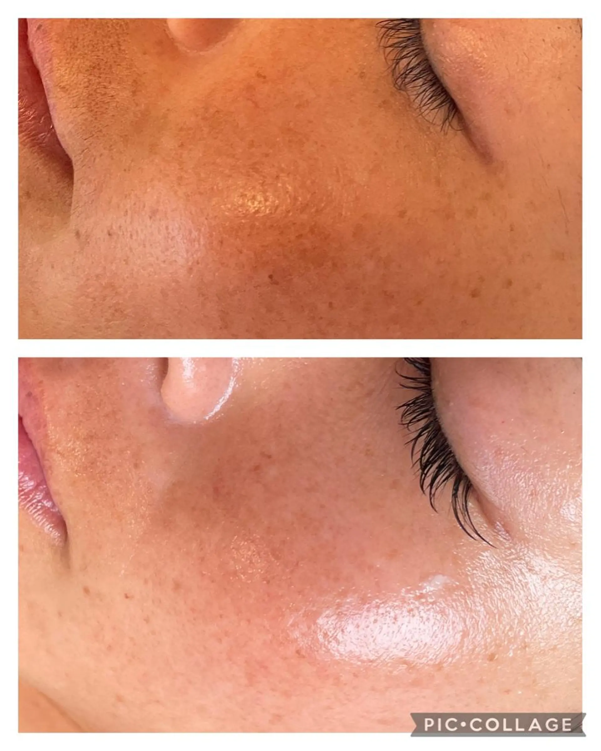 エステ 美肌とヘッド ナゴミプラスのエステ・リラクイメージ