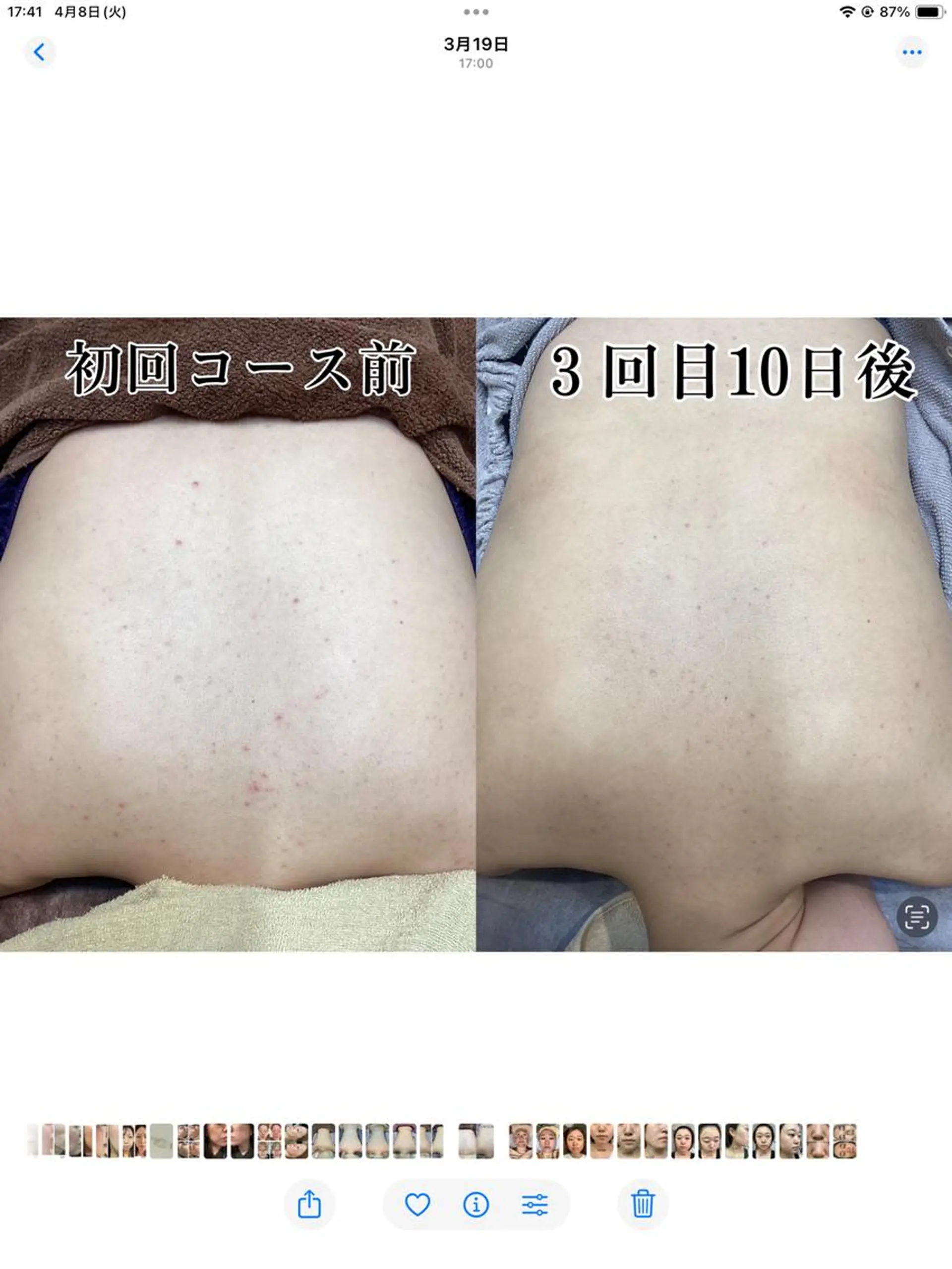 エステ リラク エステティック RAYVIS池袋🐱のエステ・リラクイメージ