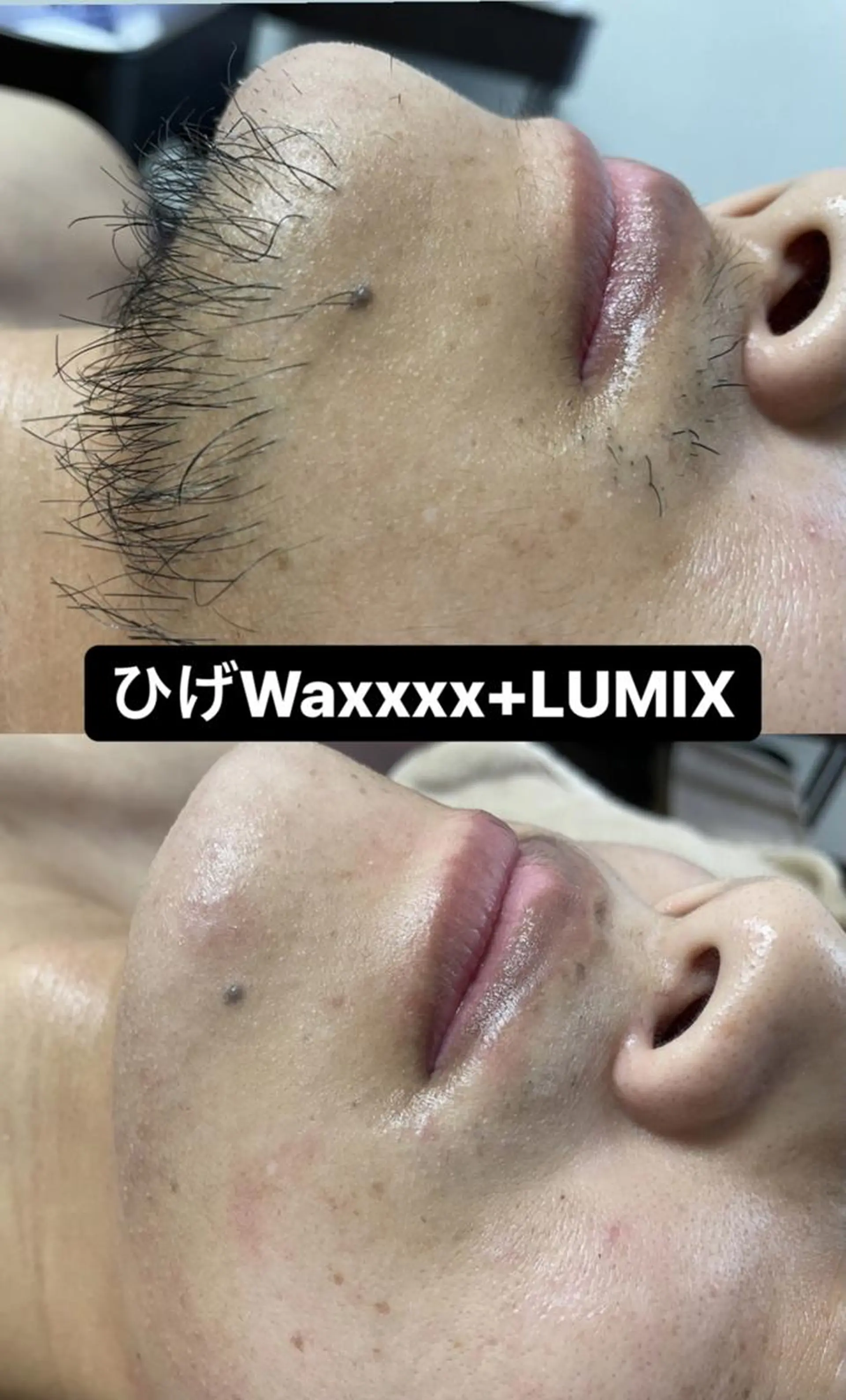 メンズ キッズ 脱毛 Epina 千葉店 【エピナ】のエステ・リラクイメージ