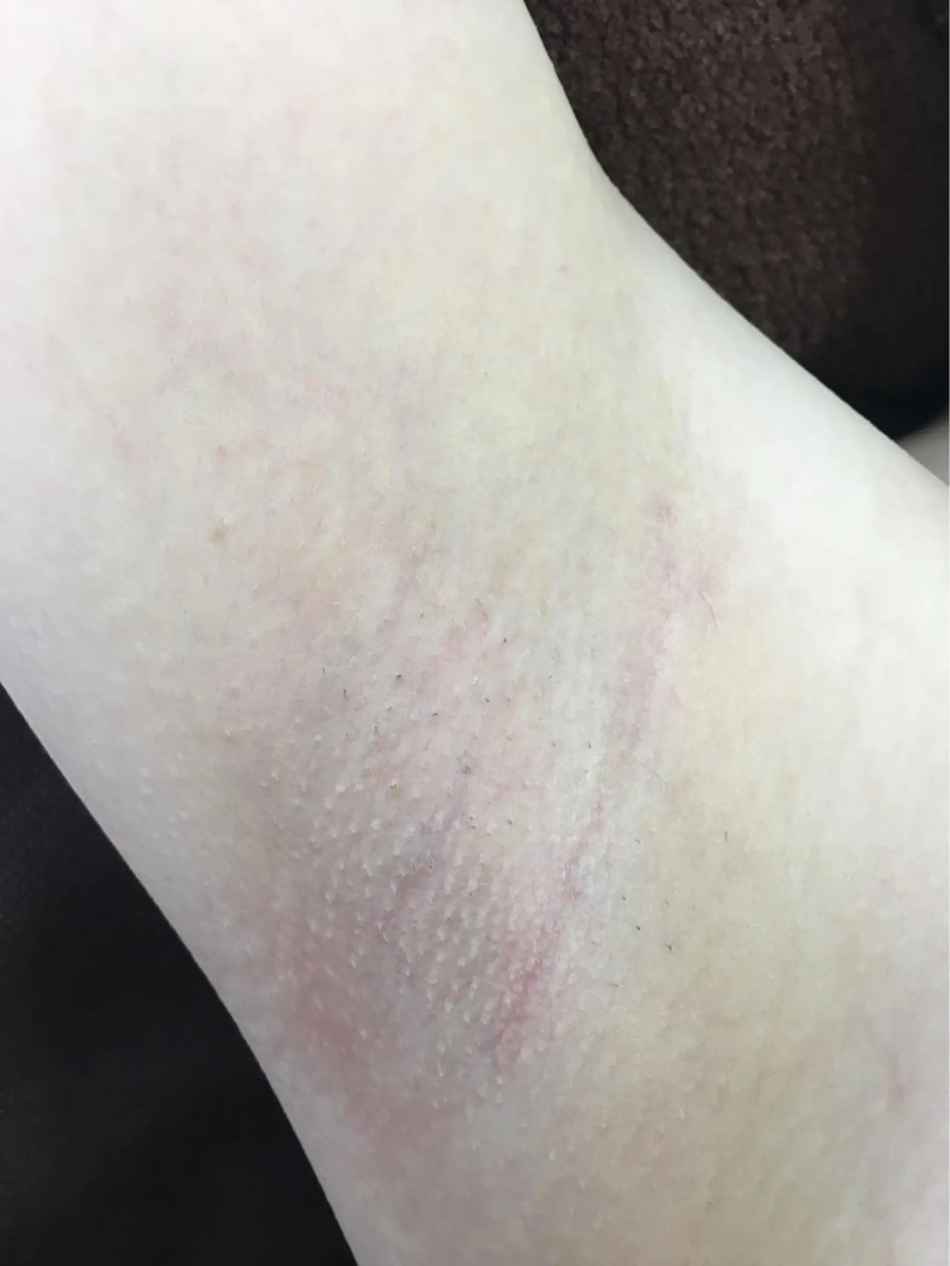 MIMI 吉祥寺2号店のエステ・リラクイメージ