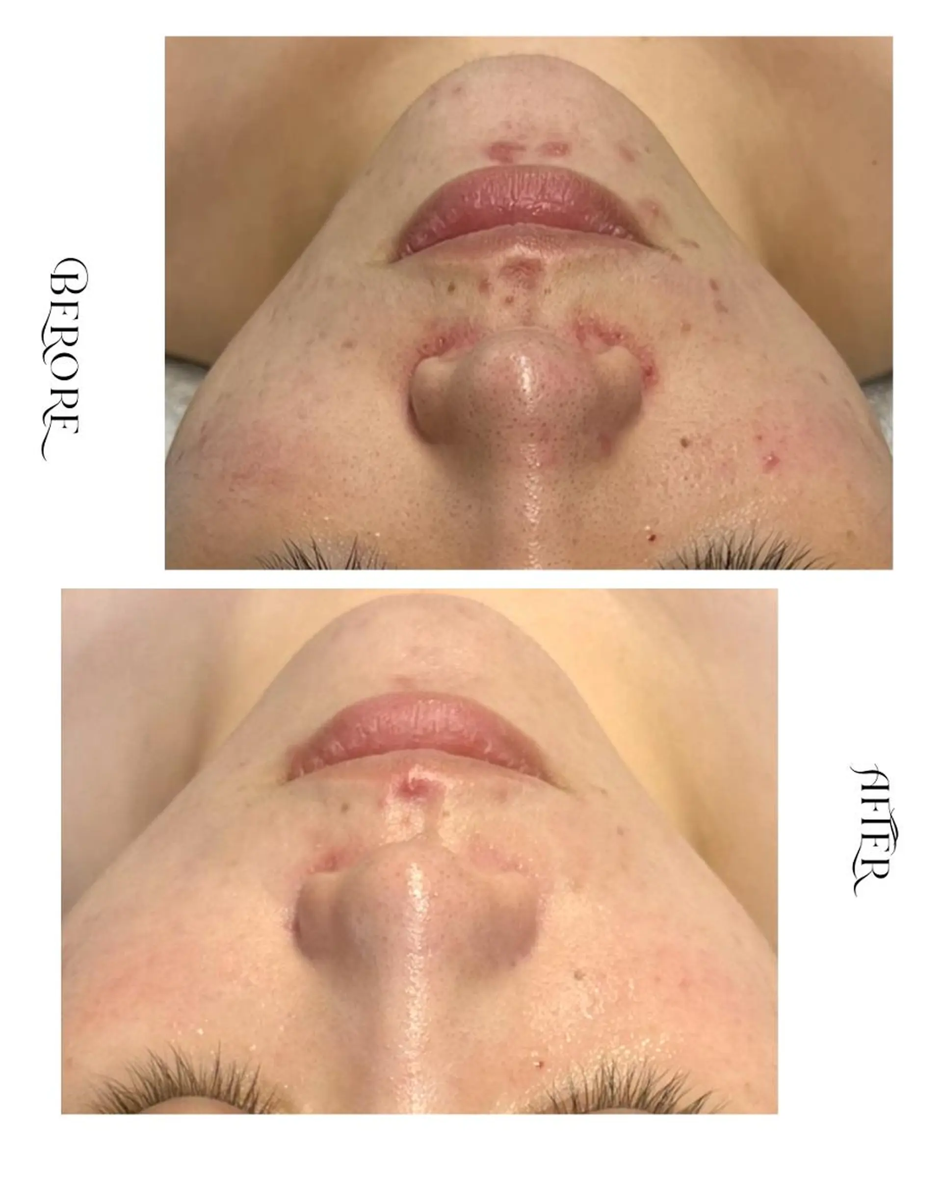 脱毛・肌質改善サロン Linoのエステ・リラクイメージ