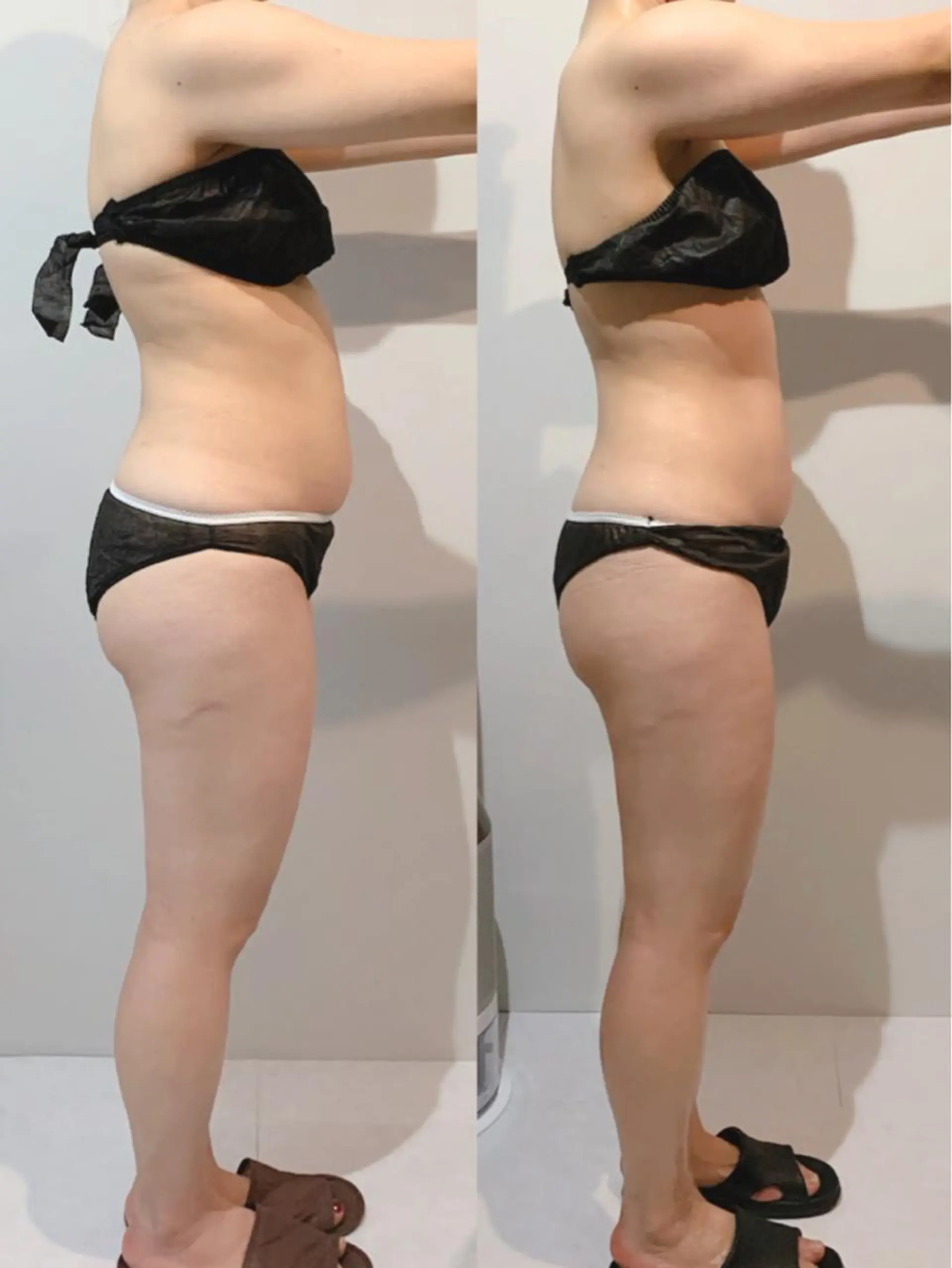 エステ リラク ボディメンテナンス shinomaのエステ・リラクイメージ