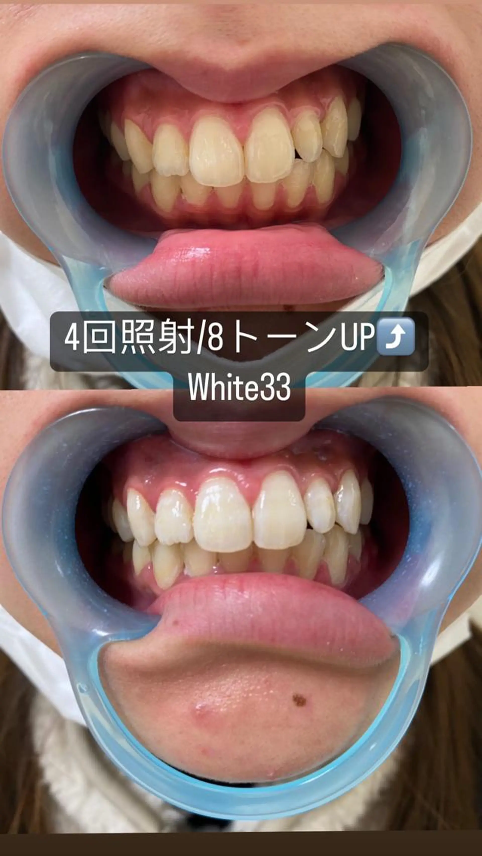 アイブロウ セルフホワイトニング White33大名のその他イメージ