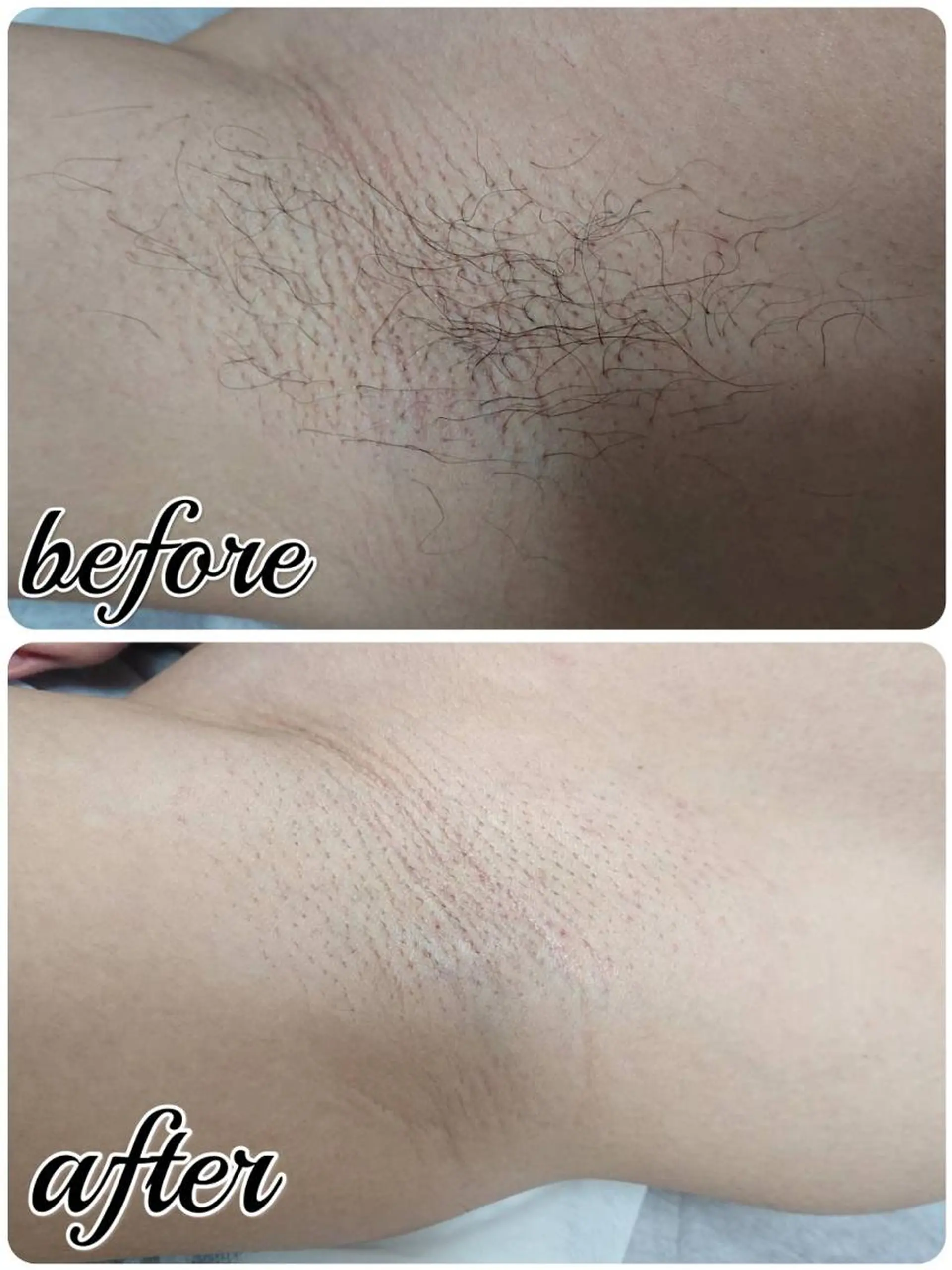 LULA池袋店 HAYASAKAのエステ・リラクイメージ