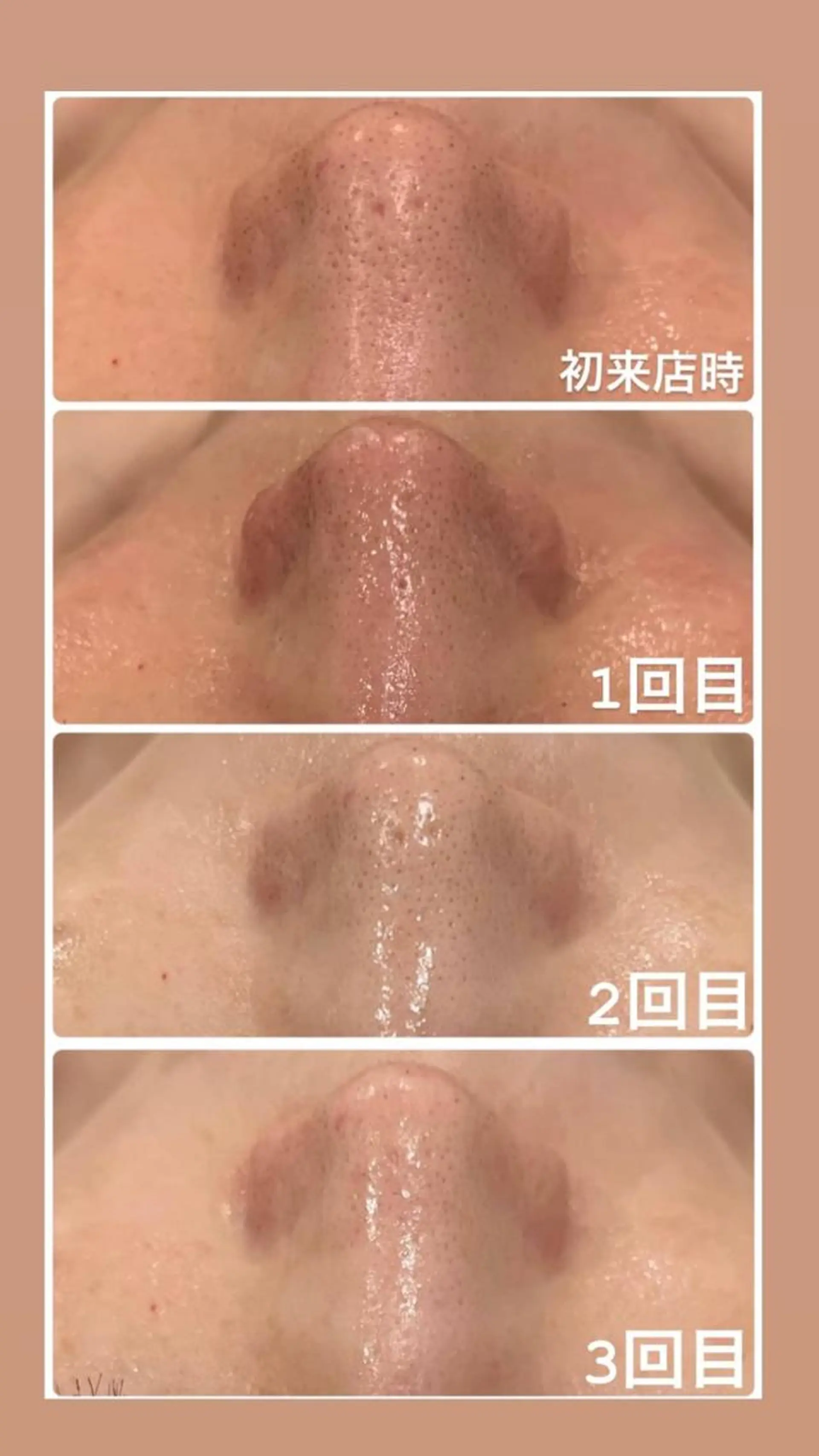 エステ リラク 立体小顔×艶肌×美ボ ディ似合わせ施術 岡のエステ・リラクイメージ