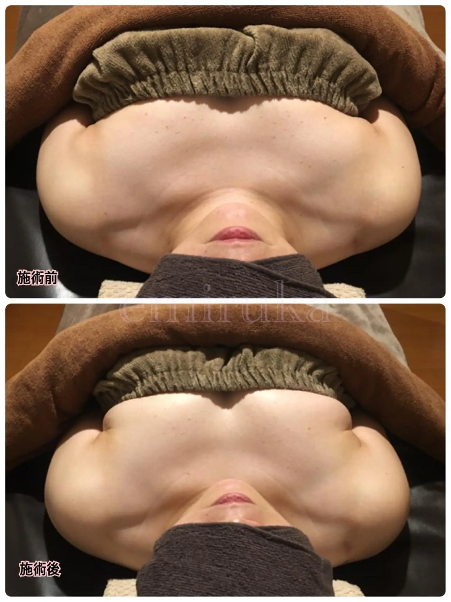 バストアップサロン エミルカのその他イメージ