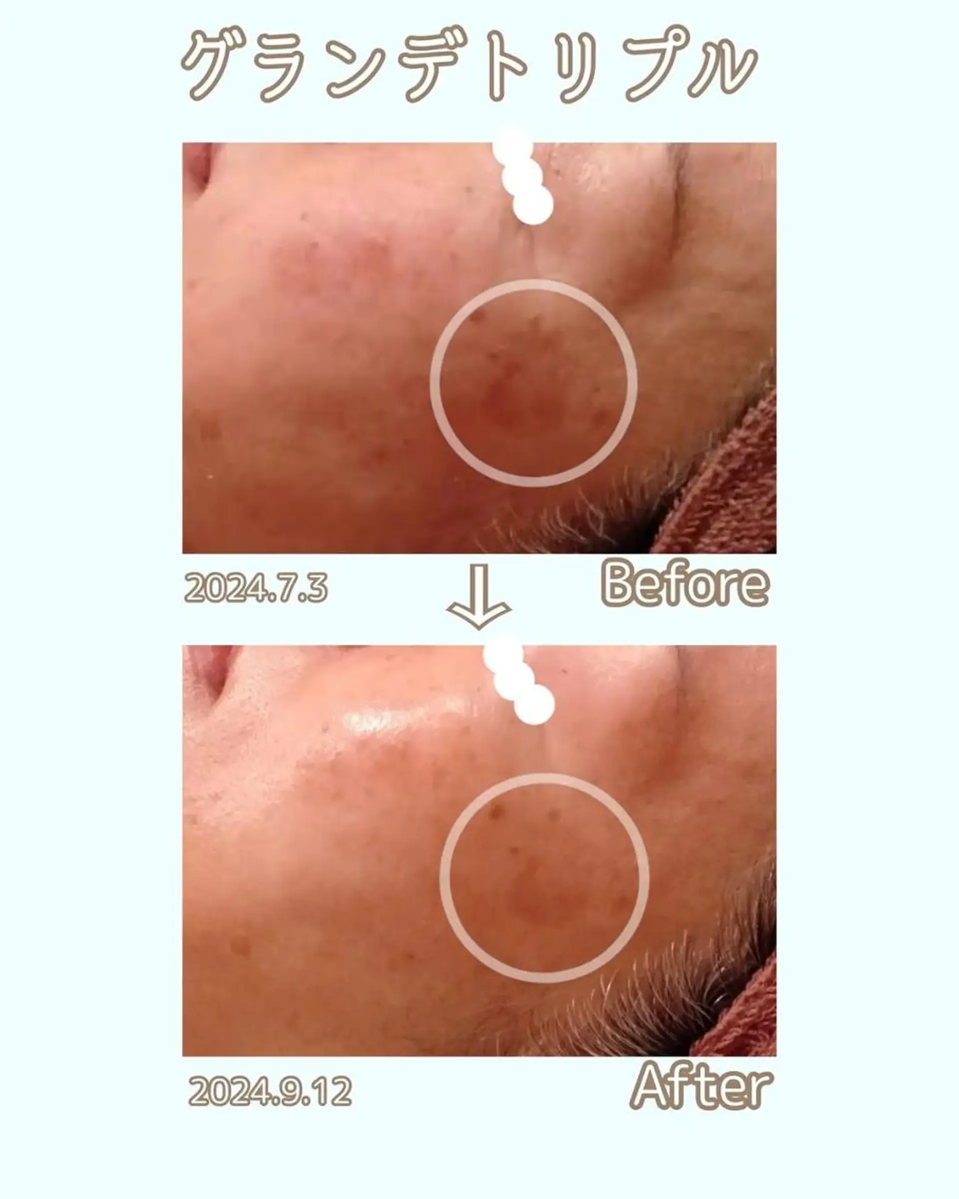 ラブニール 恵比寿店のエステ・リラクイメージ