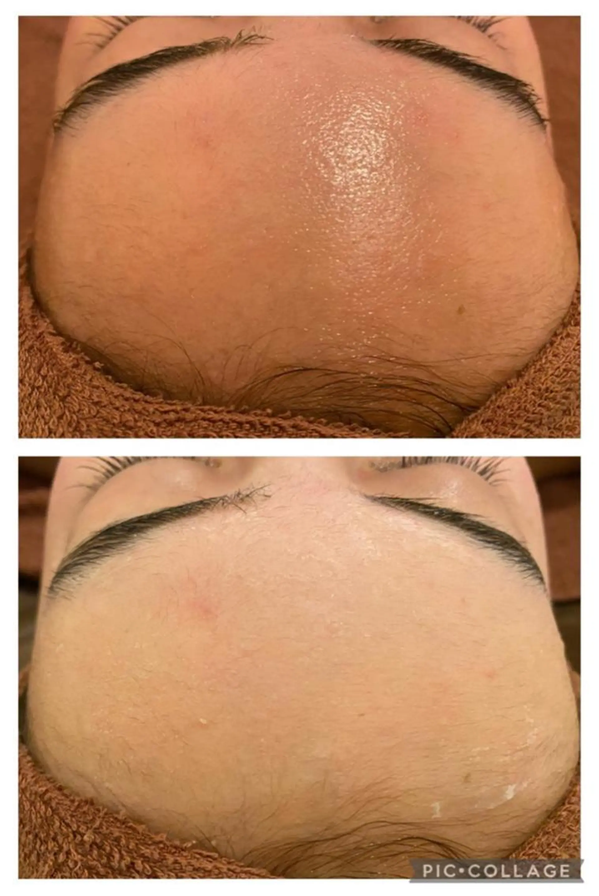 3か月で肌革命👼 ニキビ専門店💫のエステ・リラクイメージ