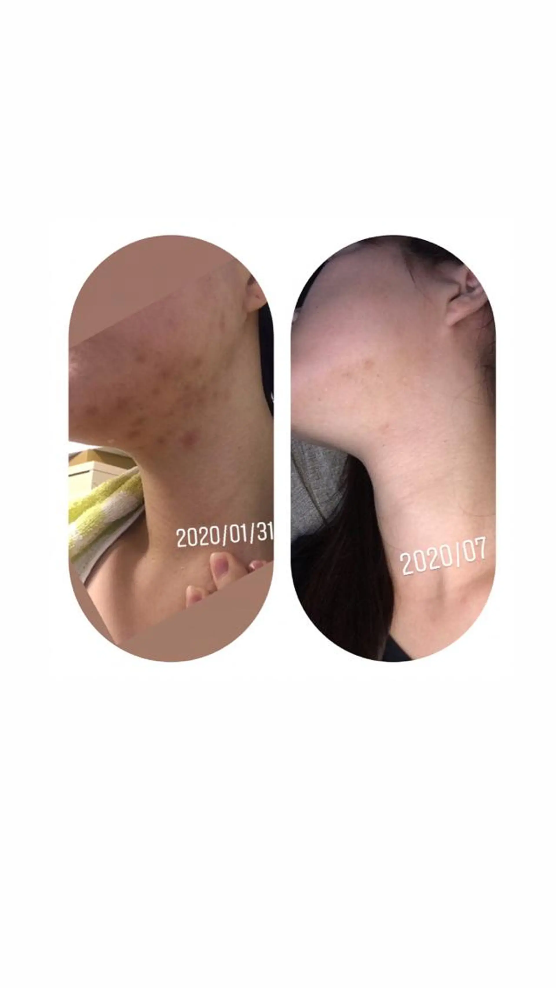 エステ 【足圧】鬼👹リンパ 身体整うサロンのエステ・リラクイメージ