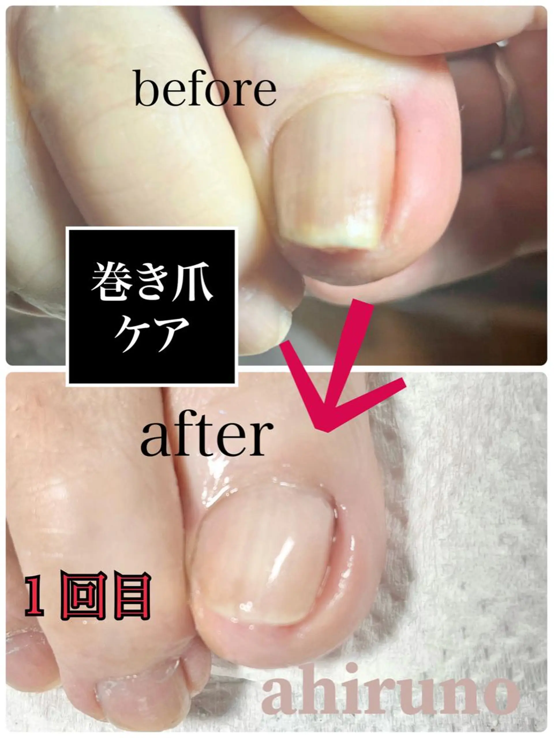 ネイル ジェルネイル フットネイル 東京あきる野市ネイル ✿ ｙｕiのネイルデザイン