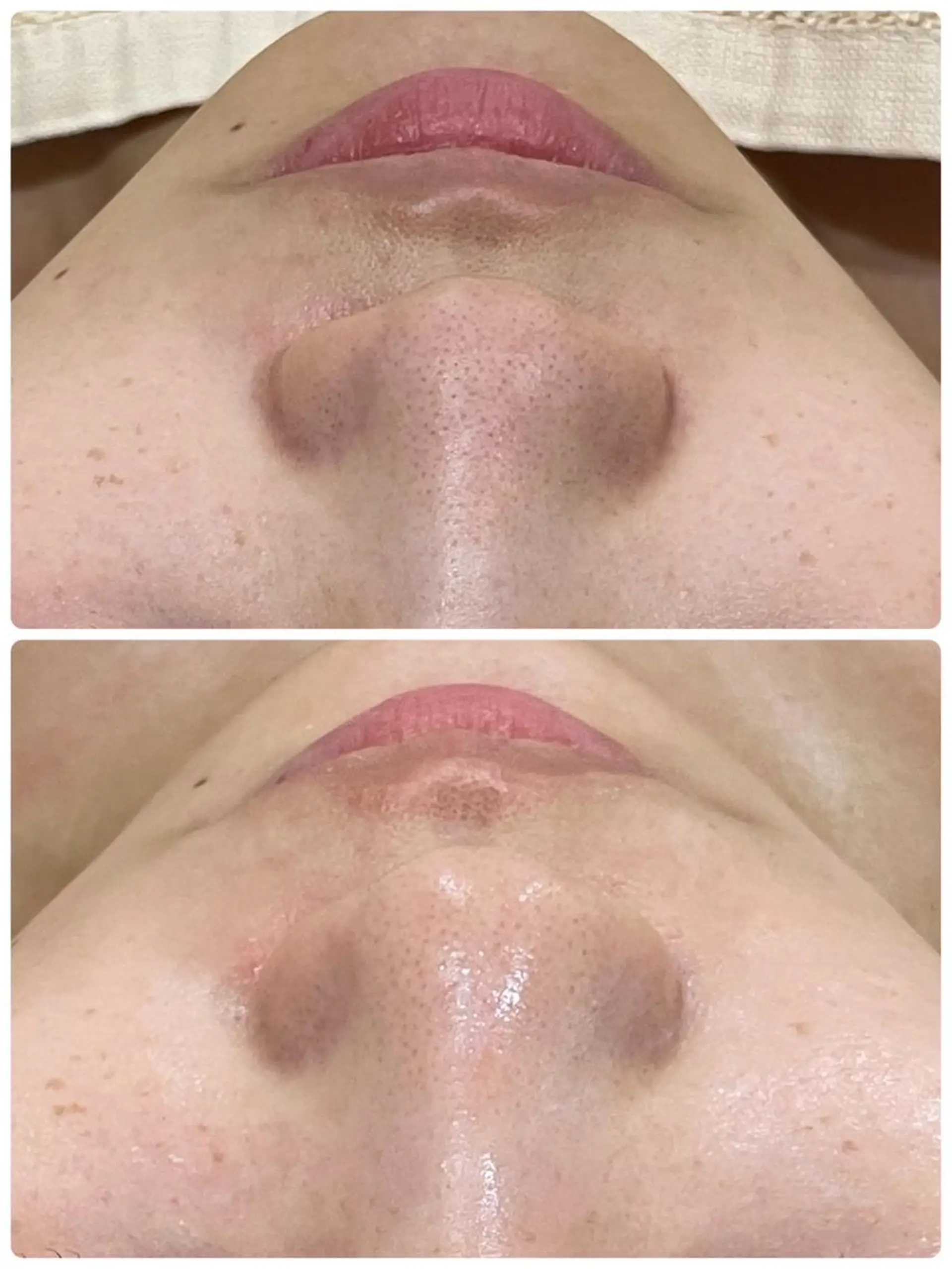 エステ矢野 ジョアアンジェ心斎橋のエステ・リラクイメージ