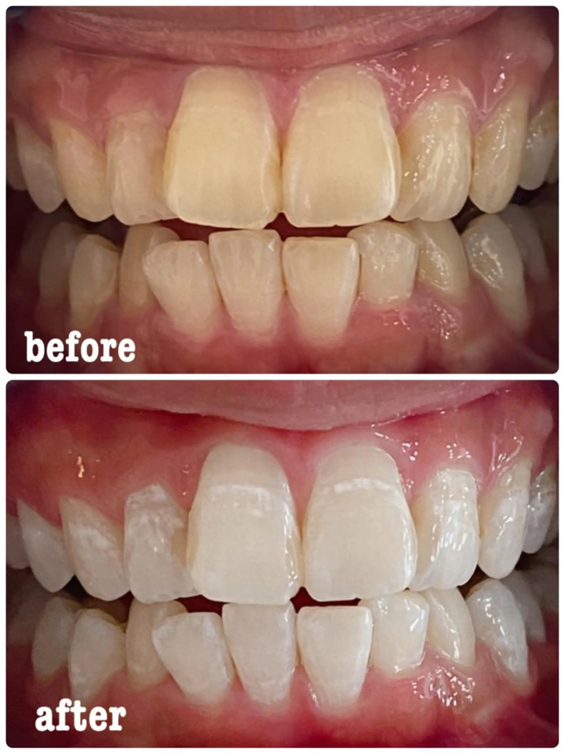 ホワイトニングサロン ラウレアのその他イメージ