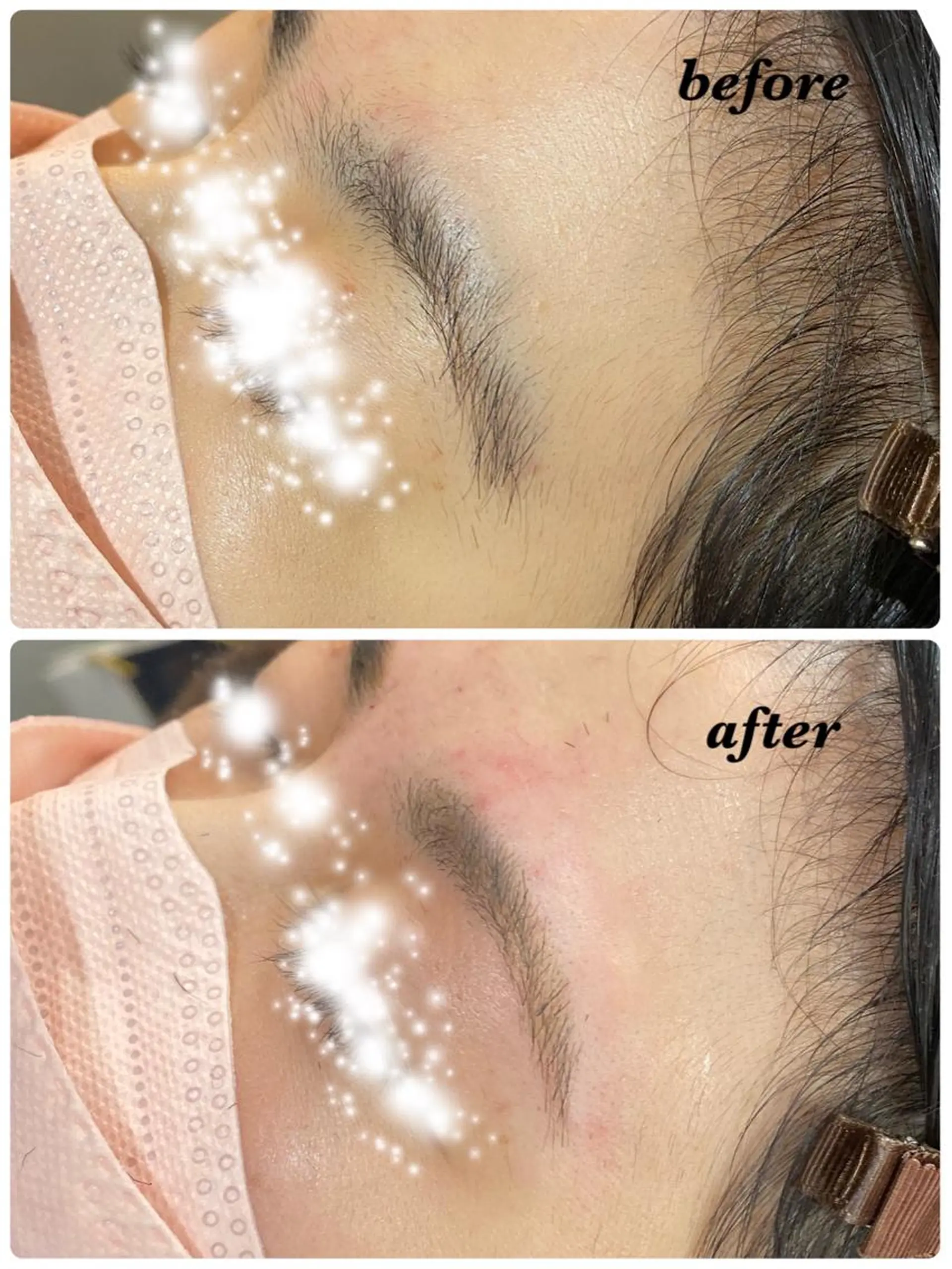 アイブロウ ハーブピーリング/韓国肌管理/フェイシャル/毛穴洗浄/眉毛/顔脱毛【糸脱毛専門】rev所属・ハーブピーリング専門 毛穴洗浄❤️眉waxのエステ・リラクイメージ