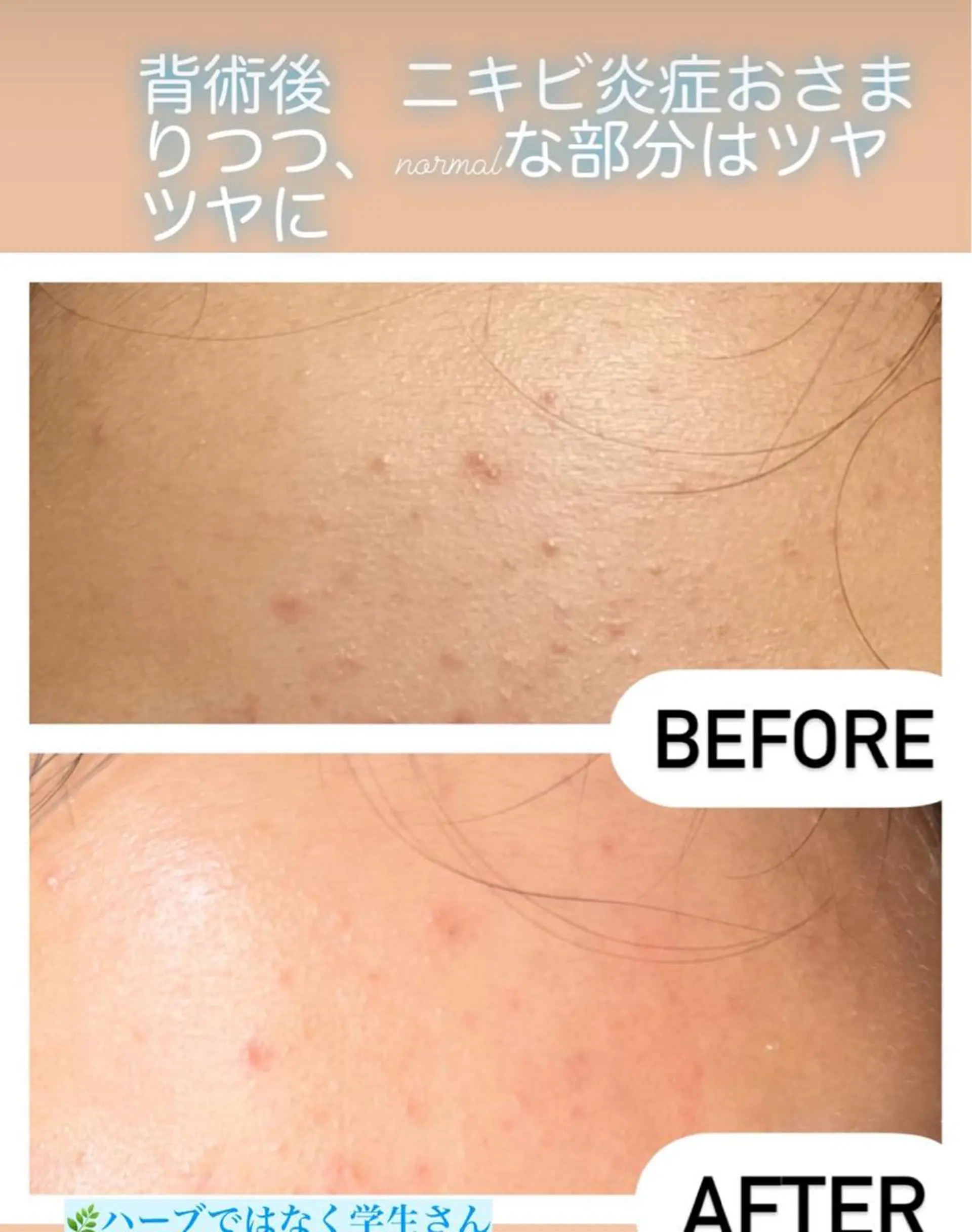 🅖🅤🅩🅔🅛 salonのエステ・リラクイメージ