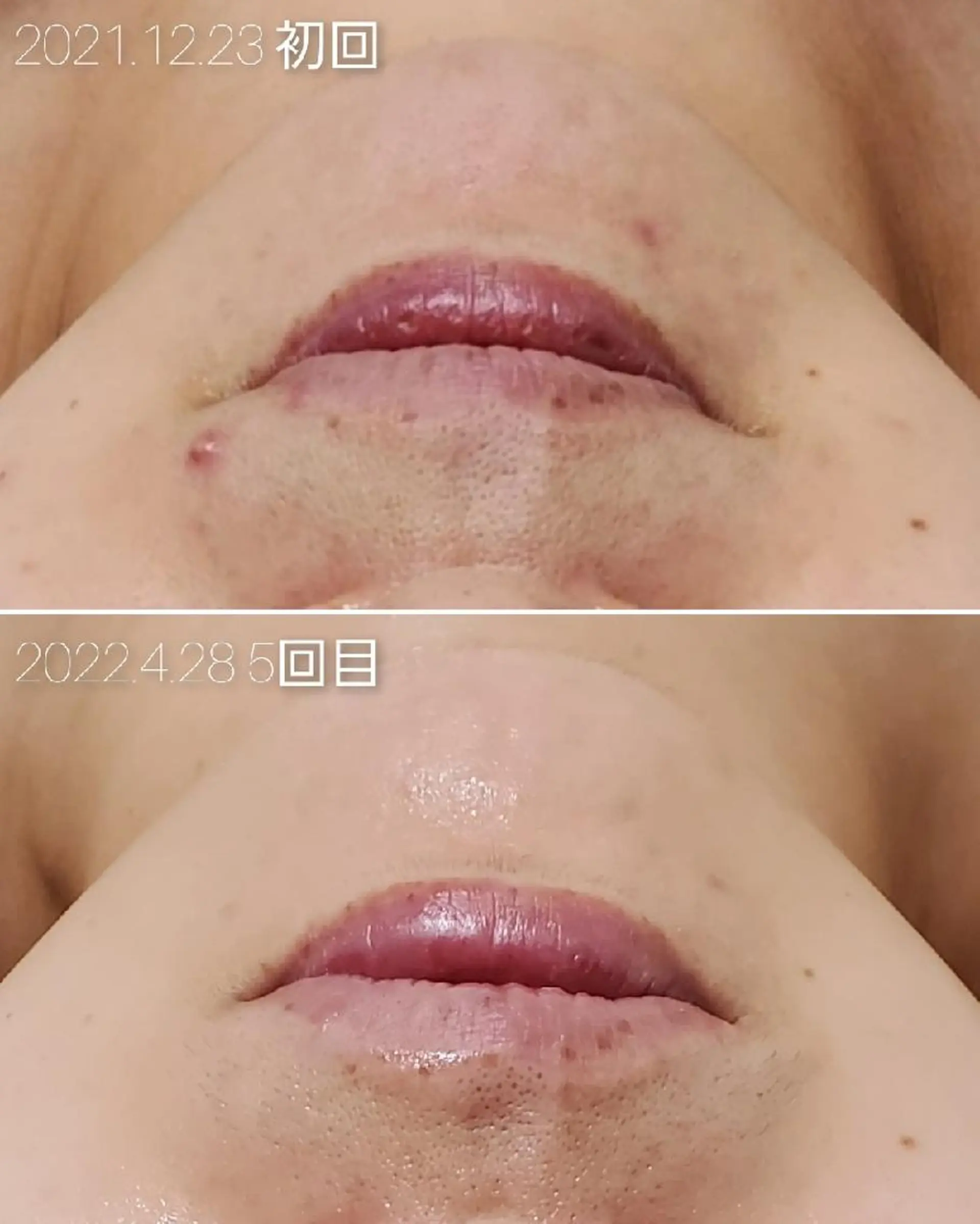 エステ ALOHA RETREATのエステ・リラクイメージ